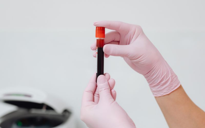 Trẻ sinh non cần khám những gì? Trẻ có thể được chỉ định xét nghiệm máu để tầm soát bệnh