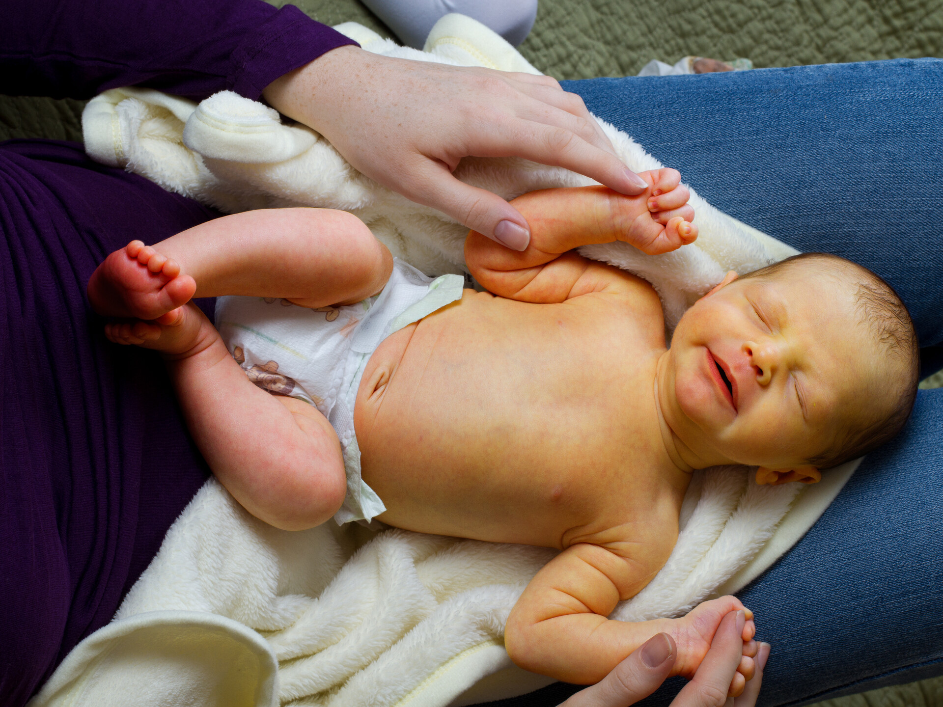 Vàng da kéo dài có thể dẫn đến vàng da nhân não gây biến chứng thần kinh nghiêm trọng