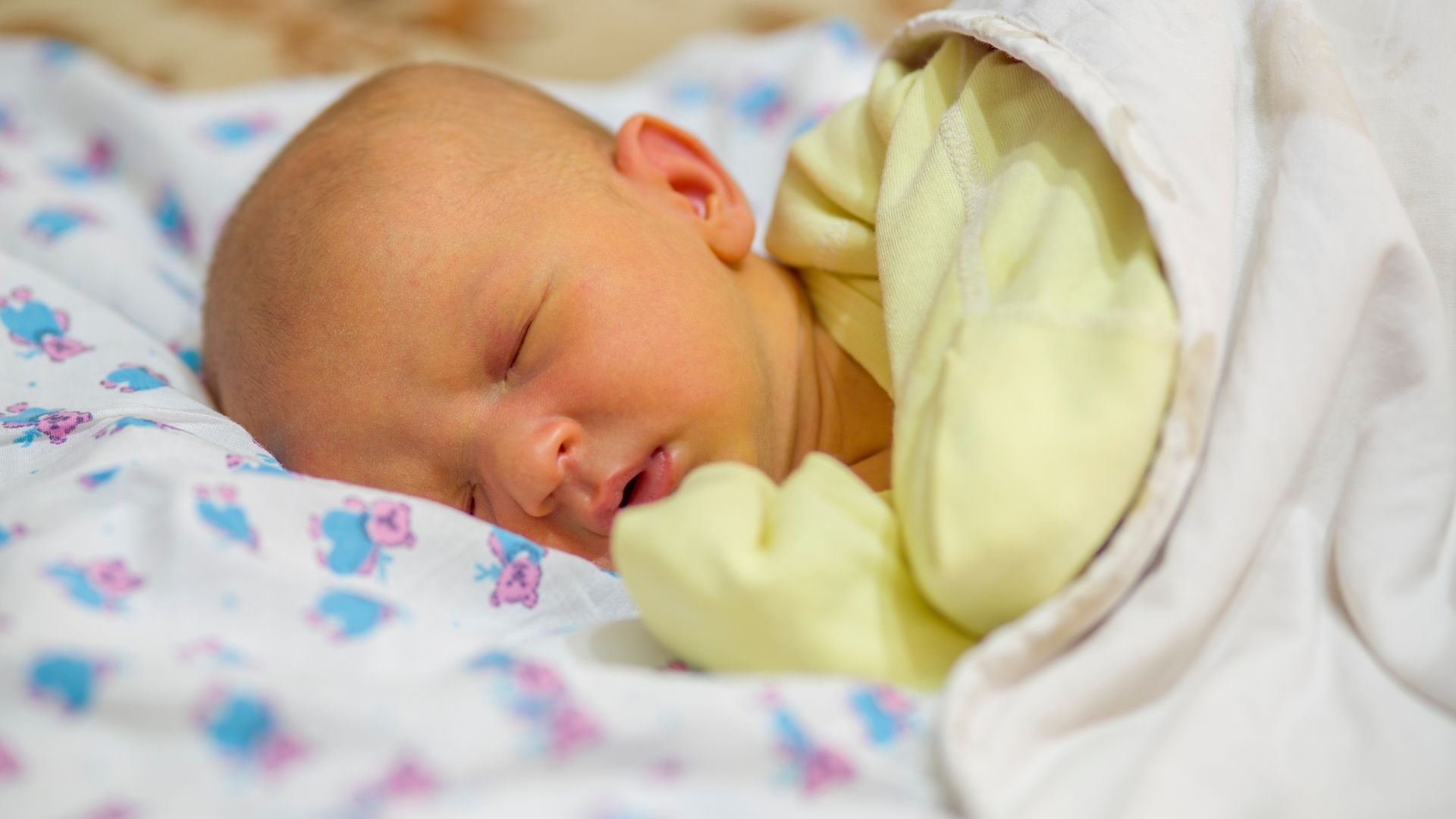 Trẻ sơ sinh 1 tháng tuổi chưa hết vàng da khiến nhiều cha mẹ lo lắng