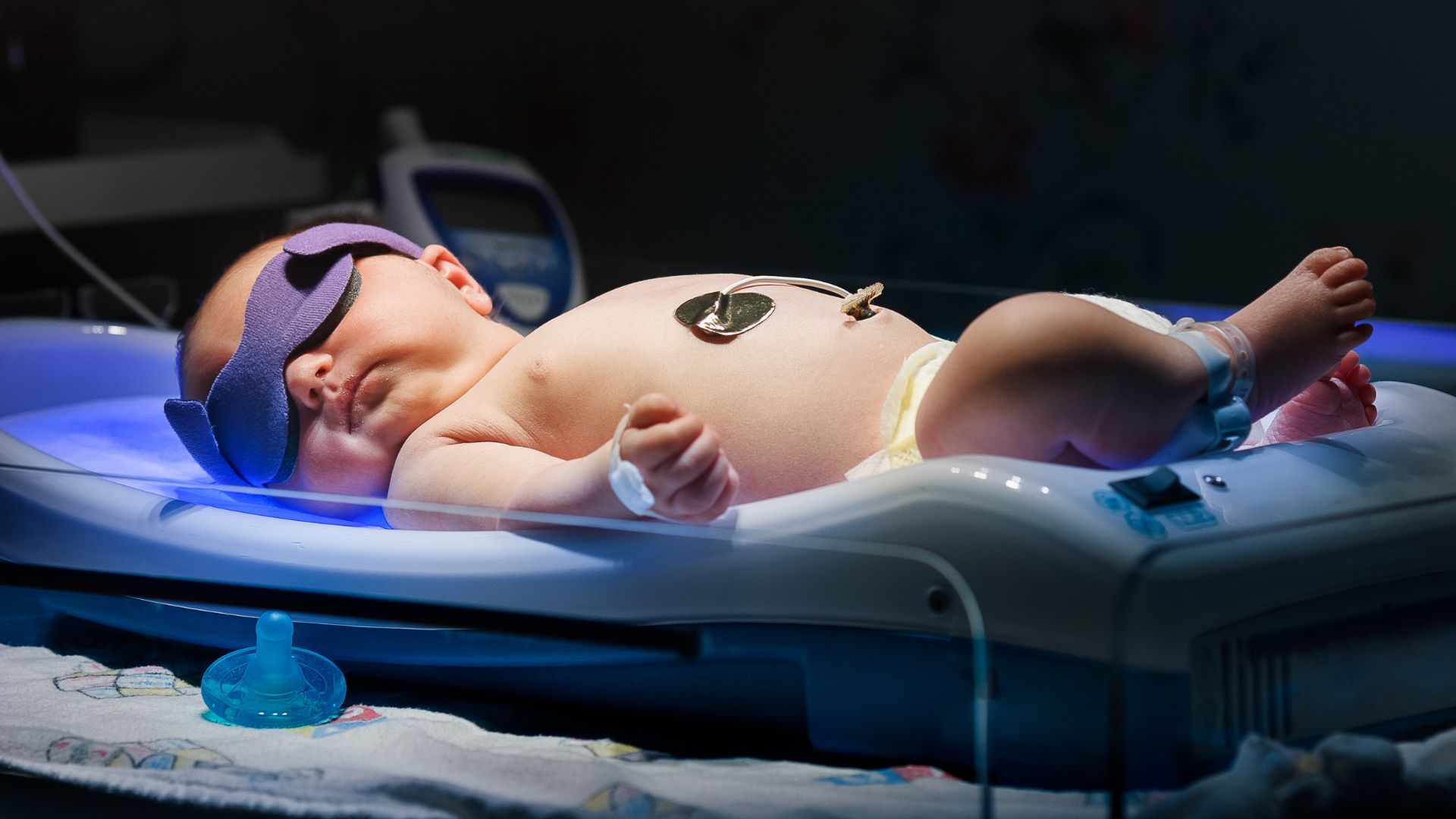 Chiếu đèn là phương pháp phổ biến điều trị trẻ sơ sinh bị vàng da