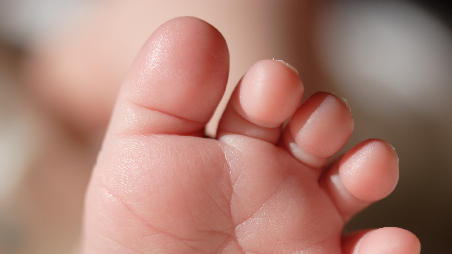 Trẻ sơ sinh nổi mụn đầu trắng trên mặt: Có đáng lo và xử lý sao cho đúng? 4