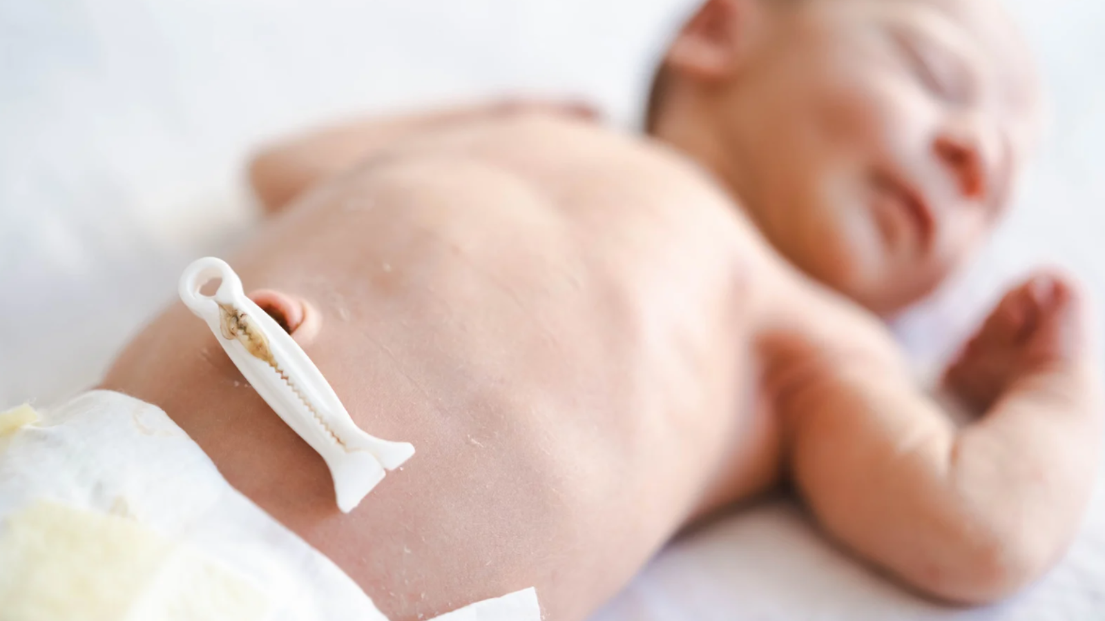 Trẻ sơ sinh rụng rốn nhưng chưa khô có sao không? 1