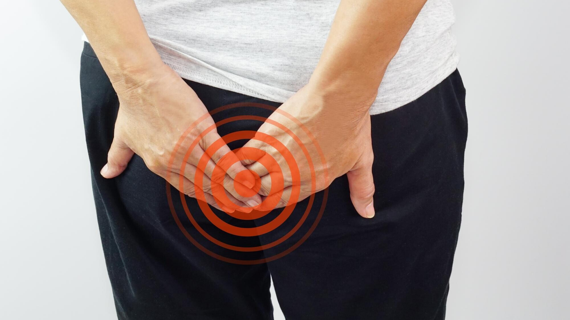 Người bị trĩ ngoại độ 1 có thể cảm thấy vùng hậu môn bị vướng, đặc biệt sau khi đi ngoài