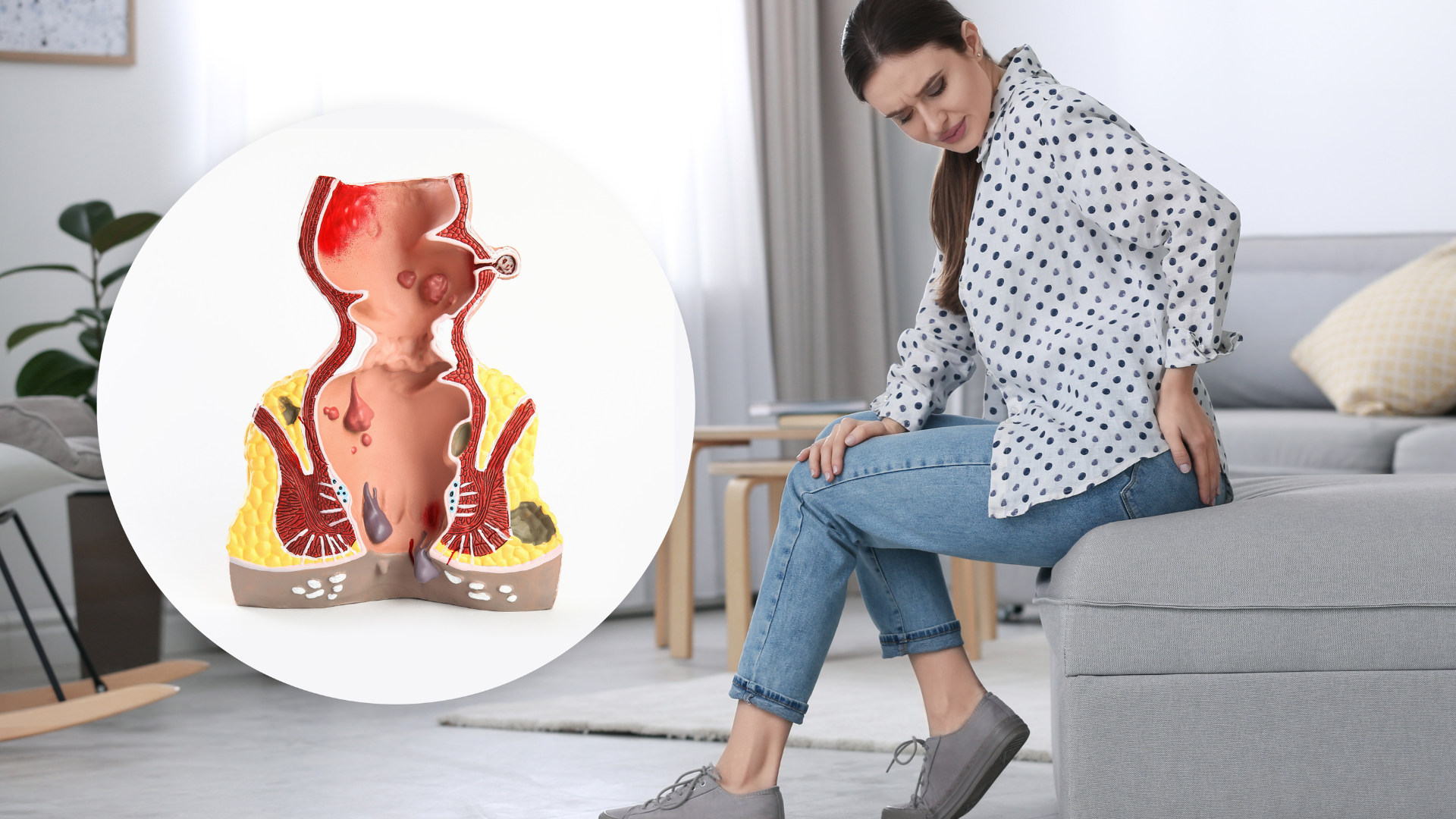 Có cảm giác đau, rát nhẹ sau khi đi vệ sinh là những dấu hiệu trĩ ngoại thường gặp