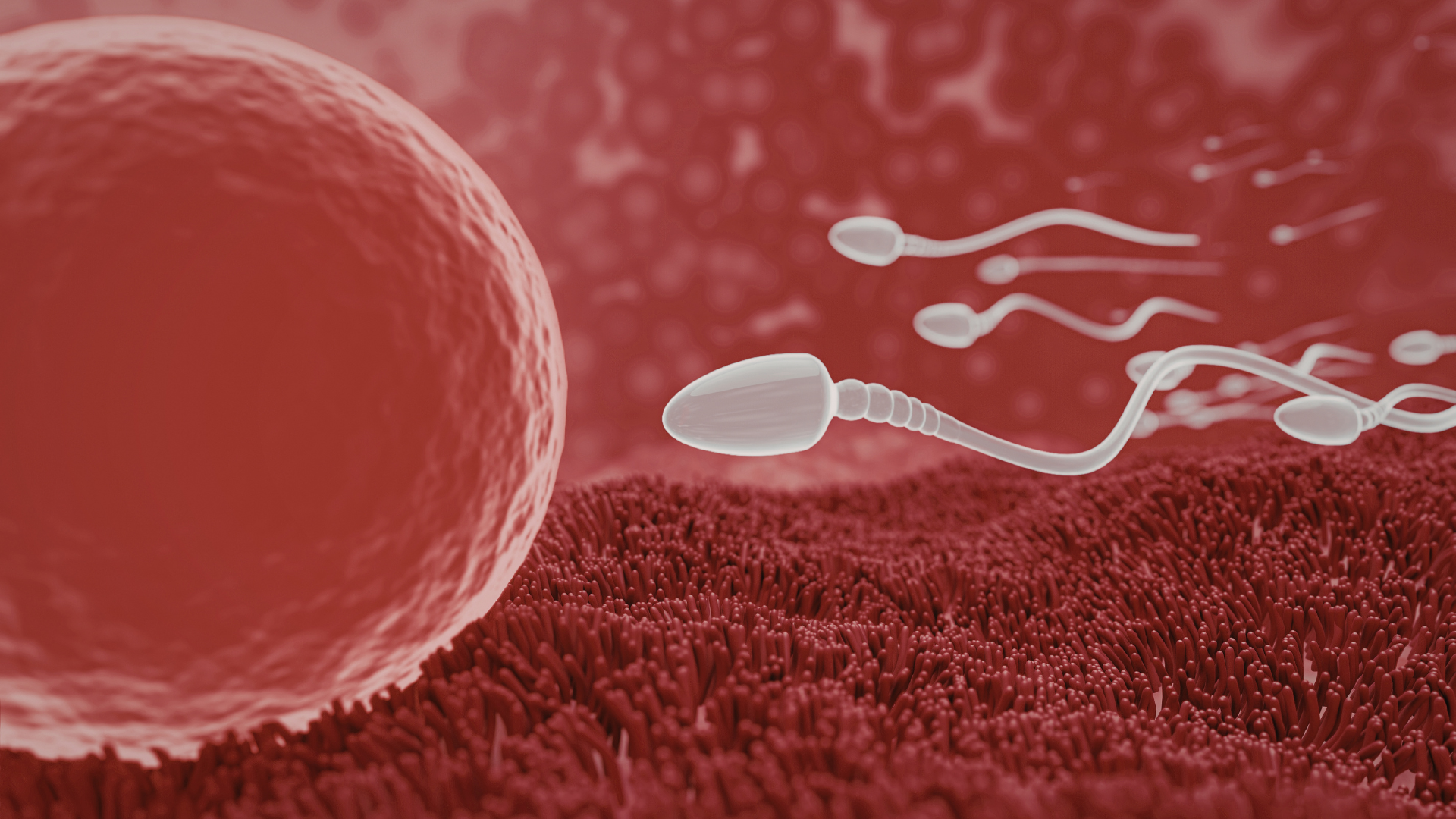 Mục tiêu chung của triệt sản nữ là ngăn đường di chuyển của trứng và tinh trùng