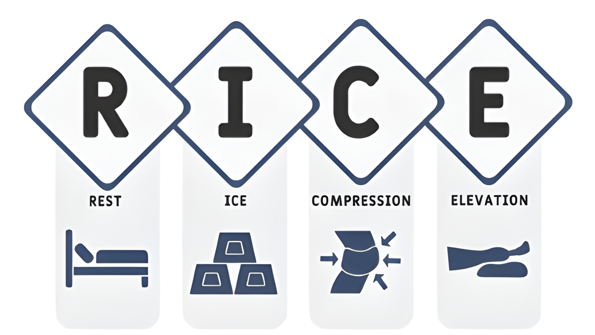 Nguyên tắc R.I.C.E là phương pháp sơ cứu được khuyến nghị rộng rãi trong y học thể thao