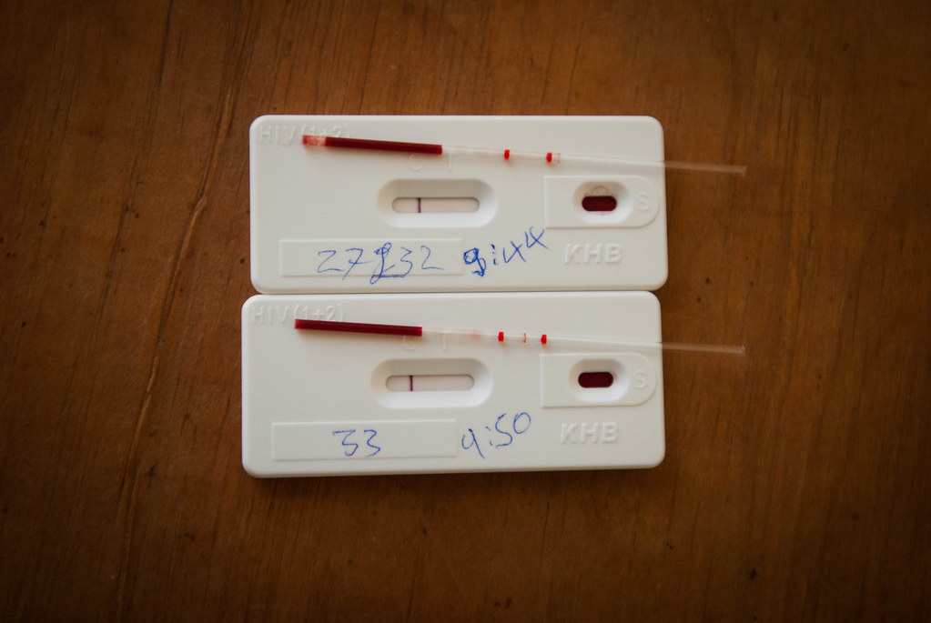 Triệu chứng phụ nữ mang thai nhiễm HIV và cách nhận biết sớm 2