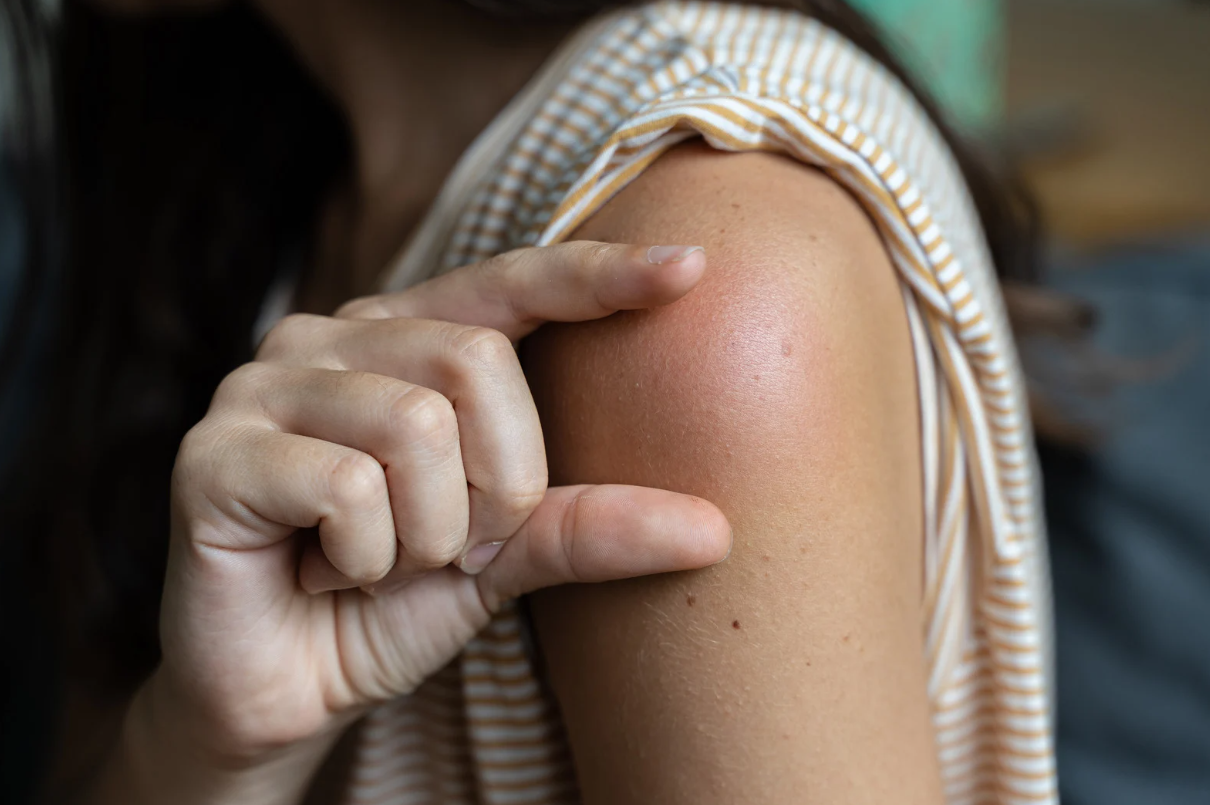 trieu-chung-sau-khi-tiem-vac-xin-nhung-dieu-can-biet 1.png