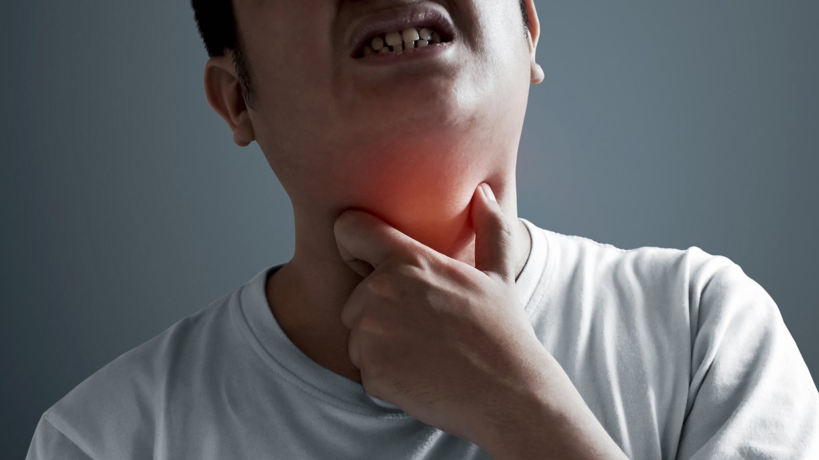Ung thư khoang miệng sống được bao lâu? Các giai đoạn của ung thư miệng. 3