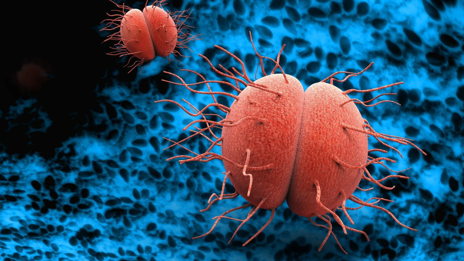 Lậu là một nhiễm khuẩn lây truyền qua đường tình dục