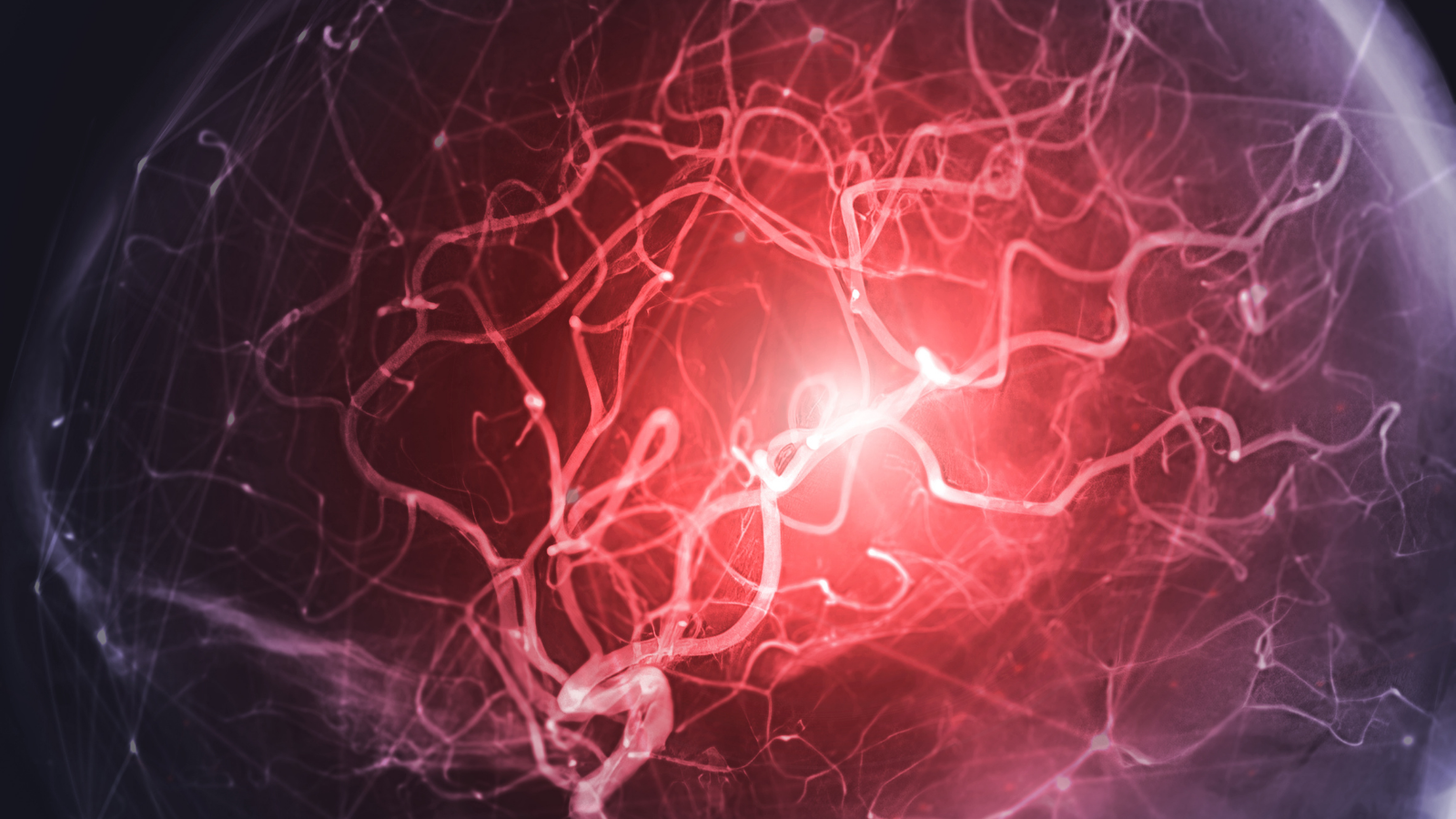 Biểu hiện thần kinh của triệu chứng xuất huyết não nhẹ