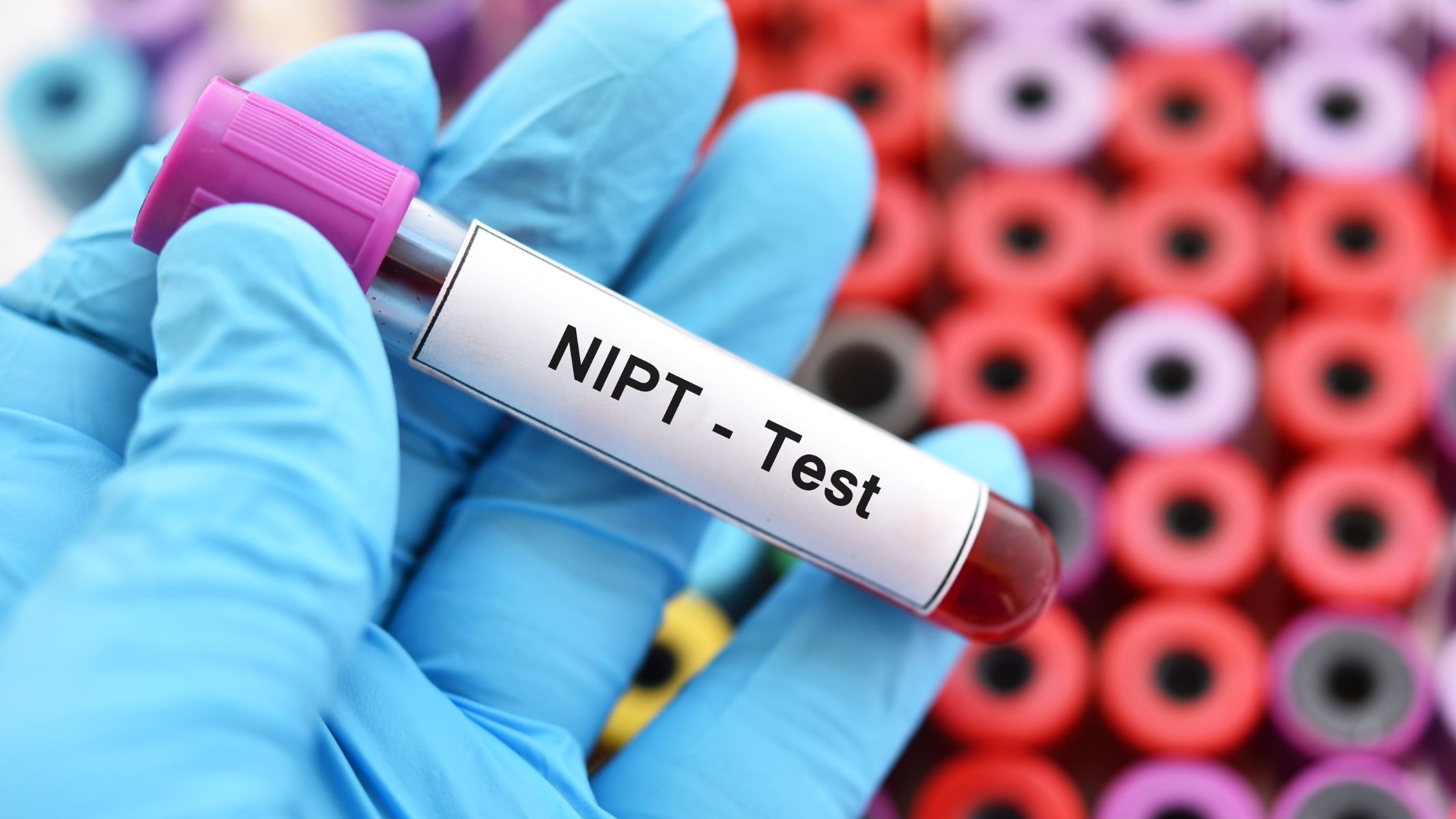 Làm xét nghiệm NIPT rồi có cần làm Triple test nữa không?