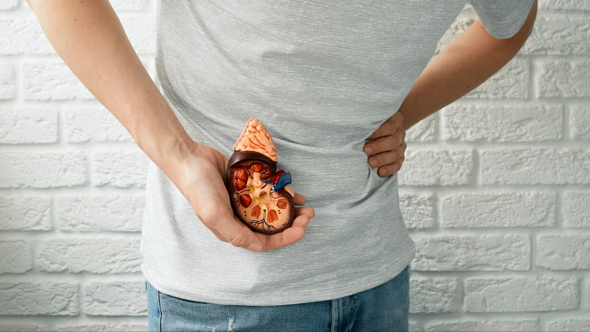 Sỏi thận gây tắc nghẽn dòng chảy nước tiểu dễ gây nhiễm vi khuẩn