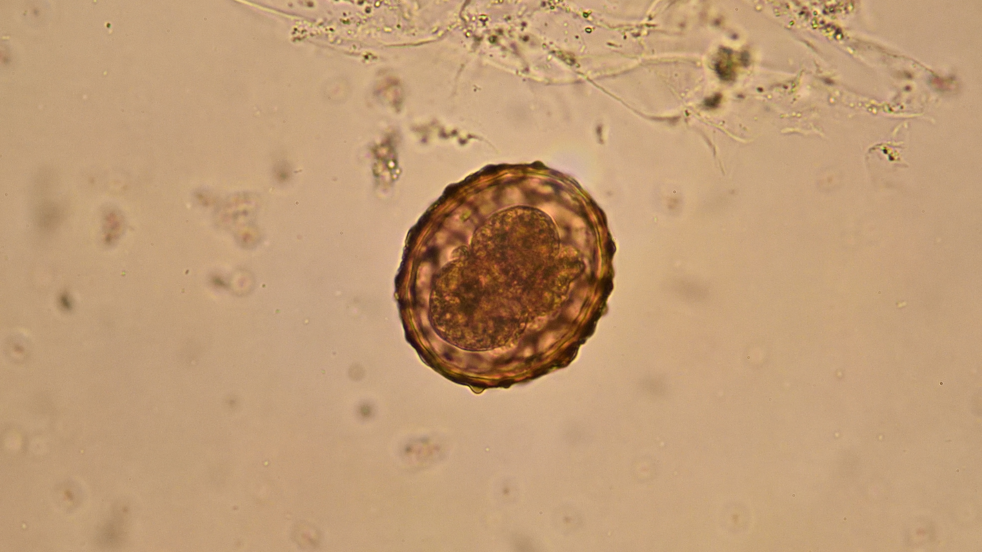 Trứng giun đũa là yếu tố trung gian chủ chốt trong vòng đời và quá trình lây lan bệnh