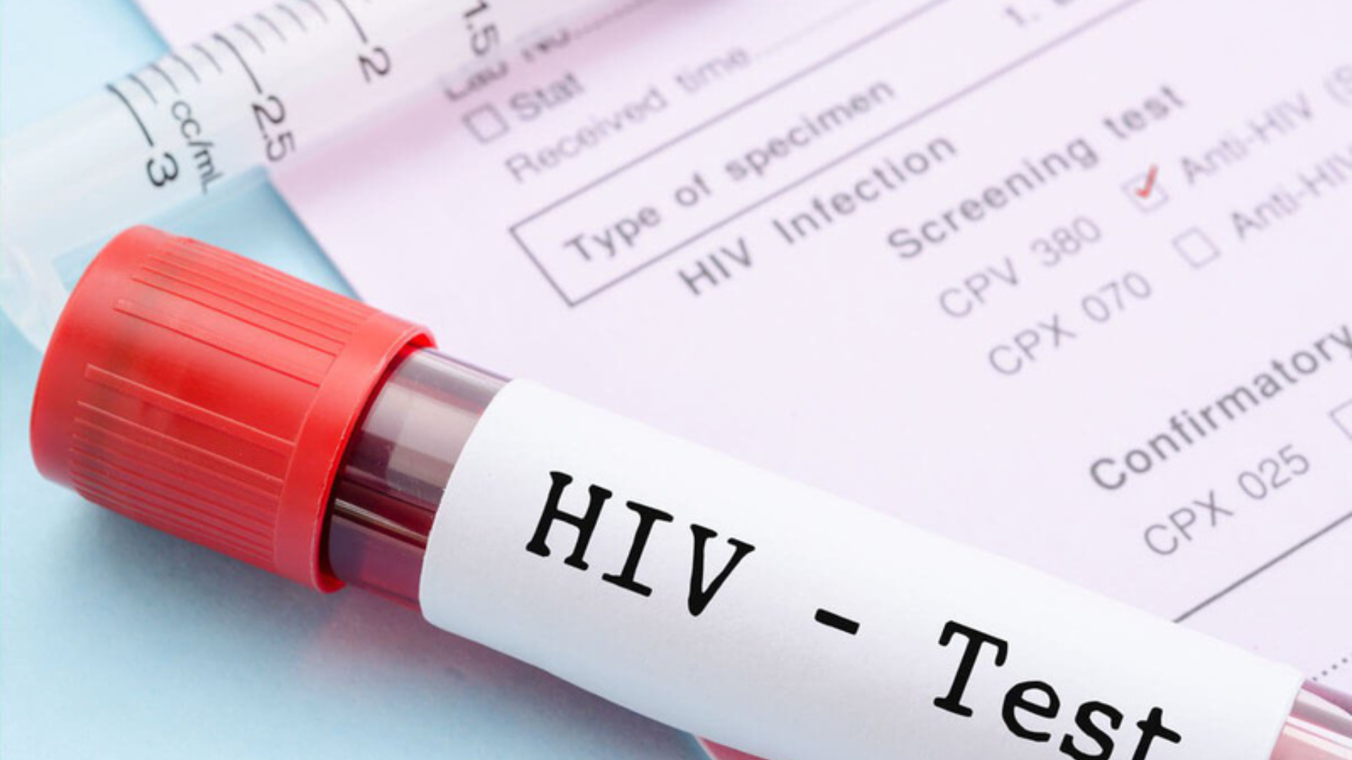 Trước khi phẫu thuật có xét nghiệm HIV không? Tùy trường hợp, bác sĩ cân nhắc theo loại phẫu thuật và nguy cơ