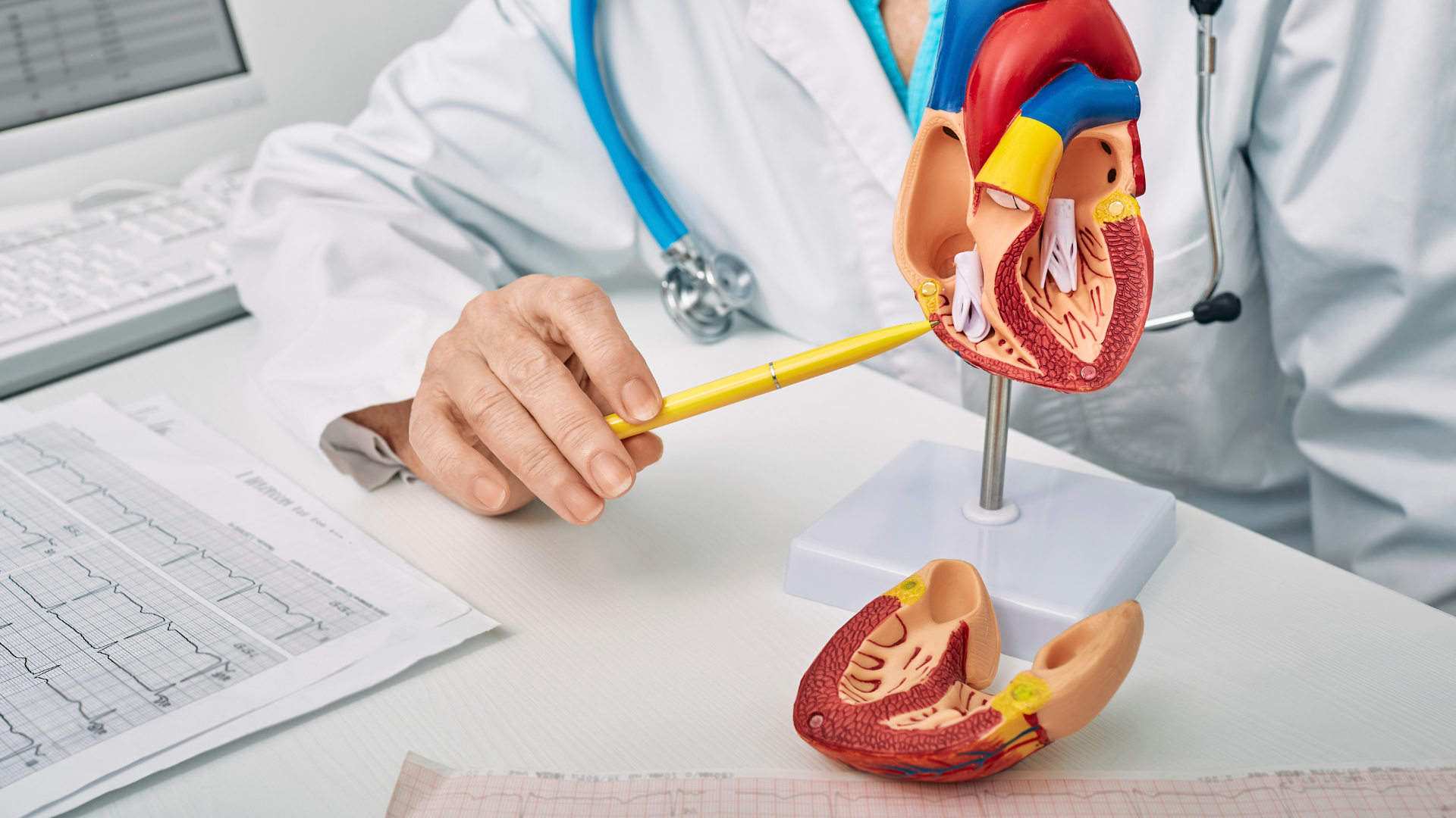 Tứ chứng Fallot là tình trạng tim bẩm sinh bao gồm bốn dị tật xảy ra cùng lúc