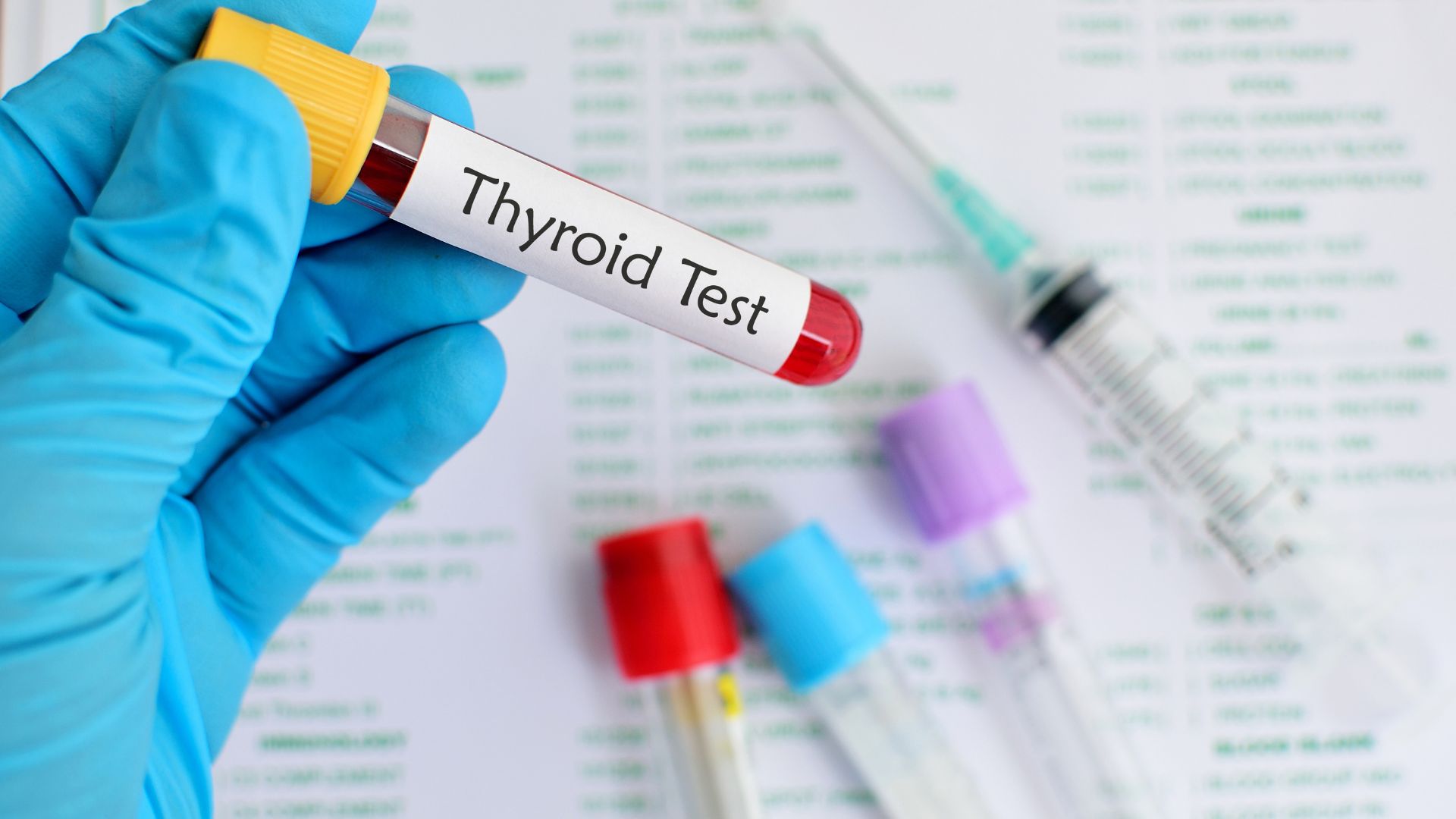 Xét nghiệm hormone tuyến giáp giúp kiểm tra sức khỏe tuyến giáp