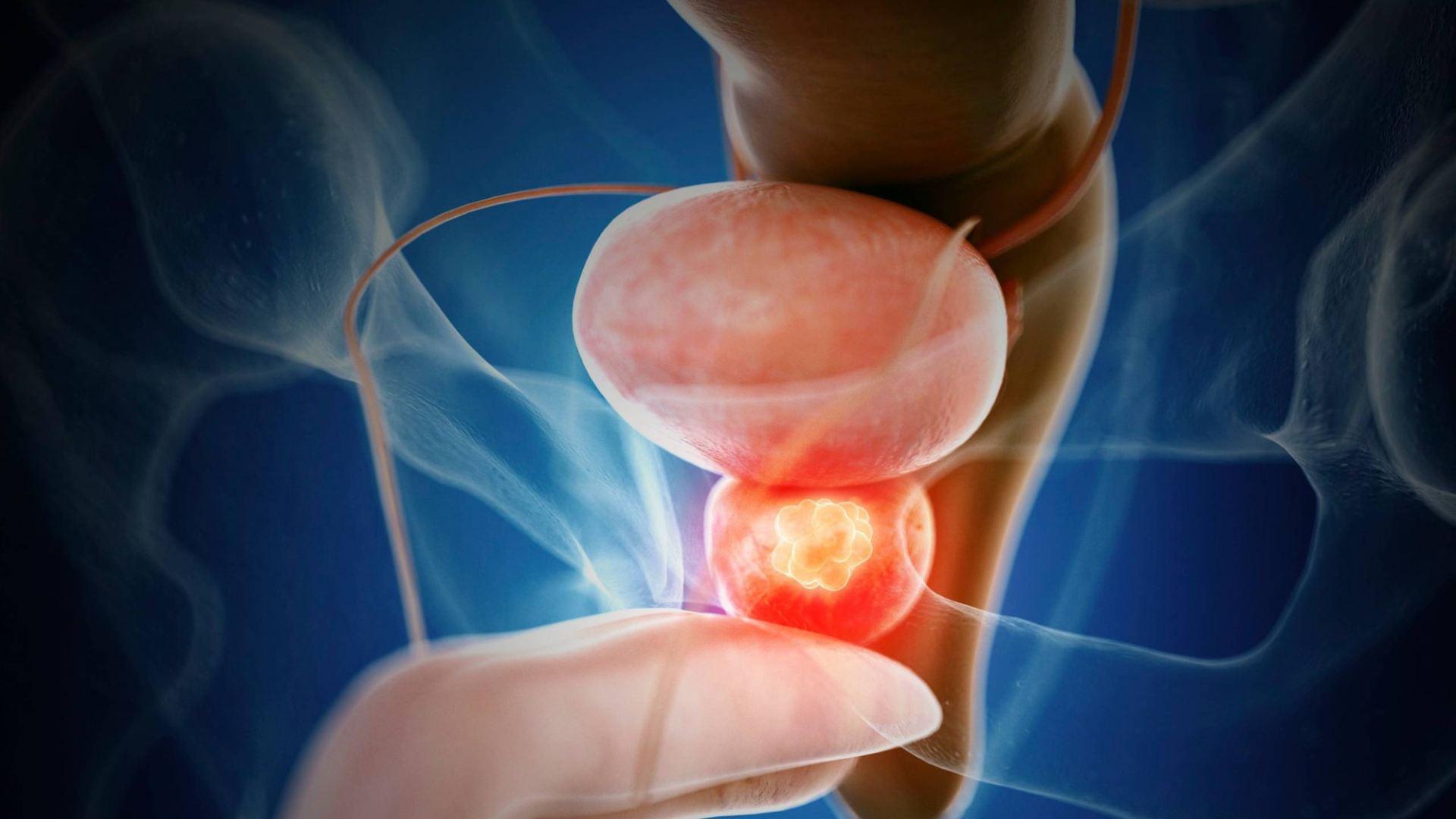 Tuyến tiền liệt là gì? Và những thông tin nam giới cần biết 5