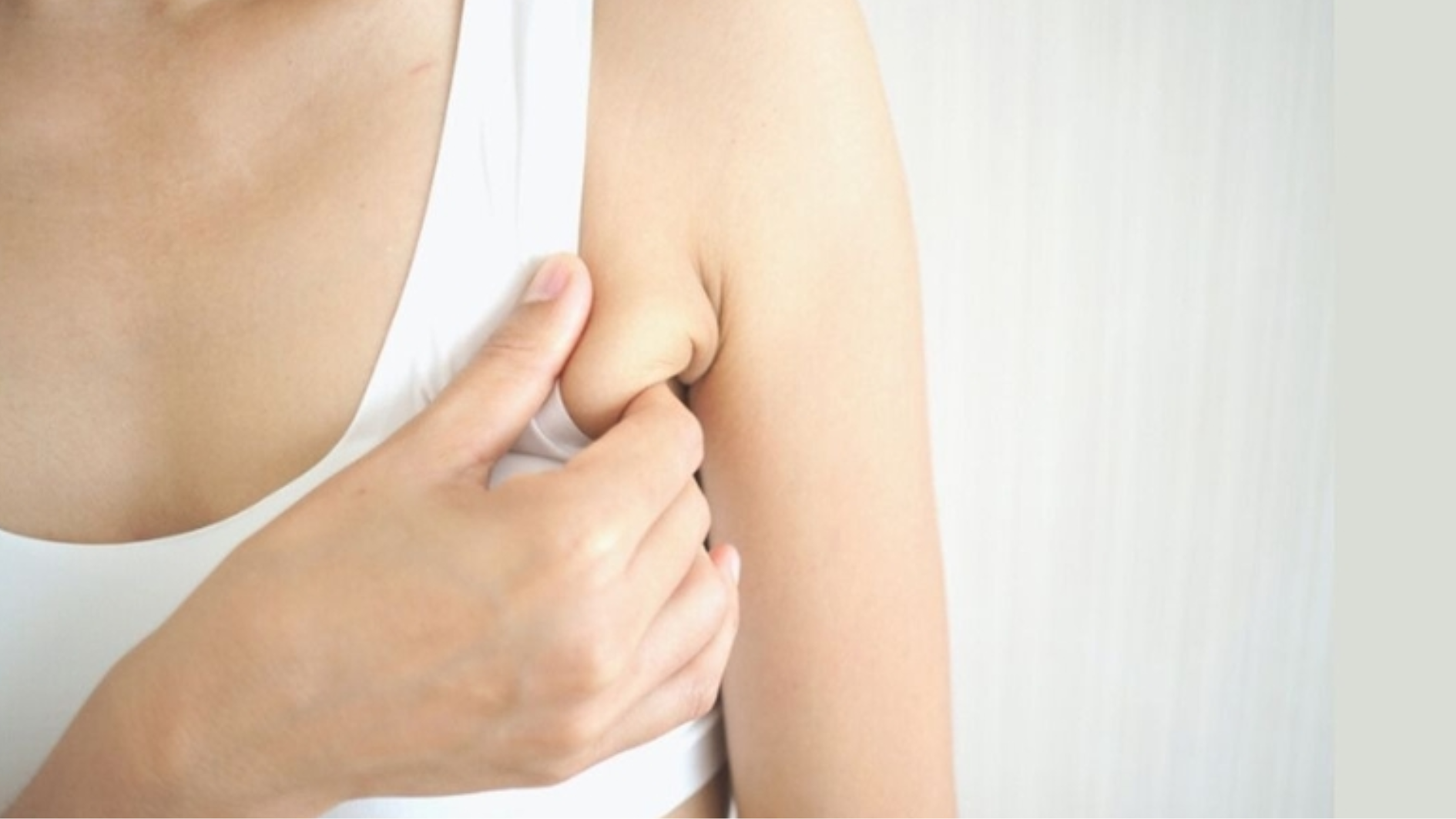 Tuyến vú phụ thường gây mất thẩm mỹ