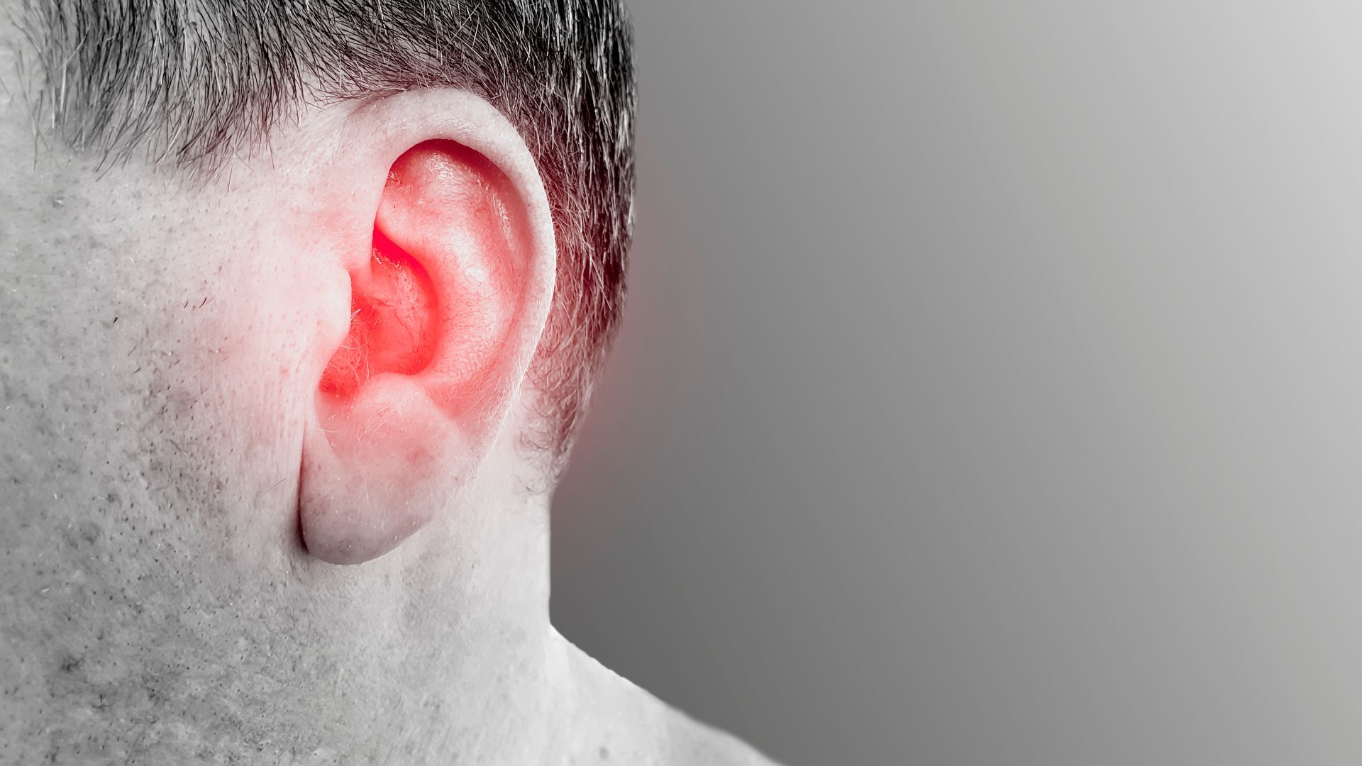 Tiền sử viêm tai ngoài là một trong các yếu tố làm tăng nguy cơ mắc u bã đậu ở tai