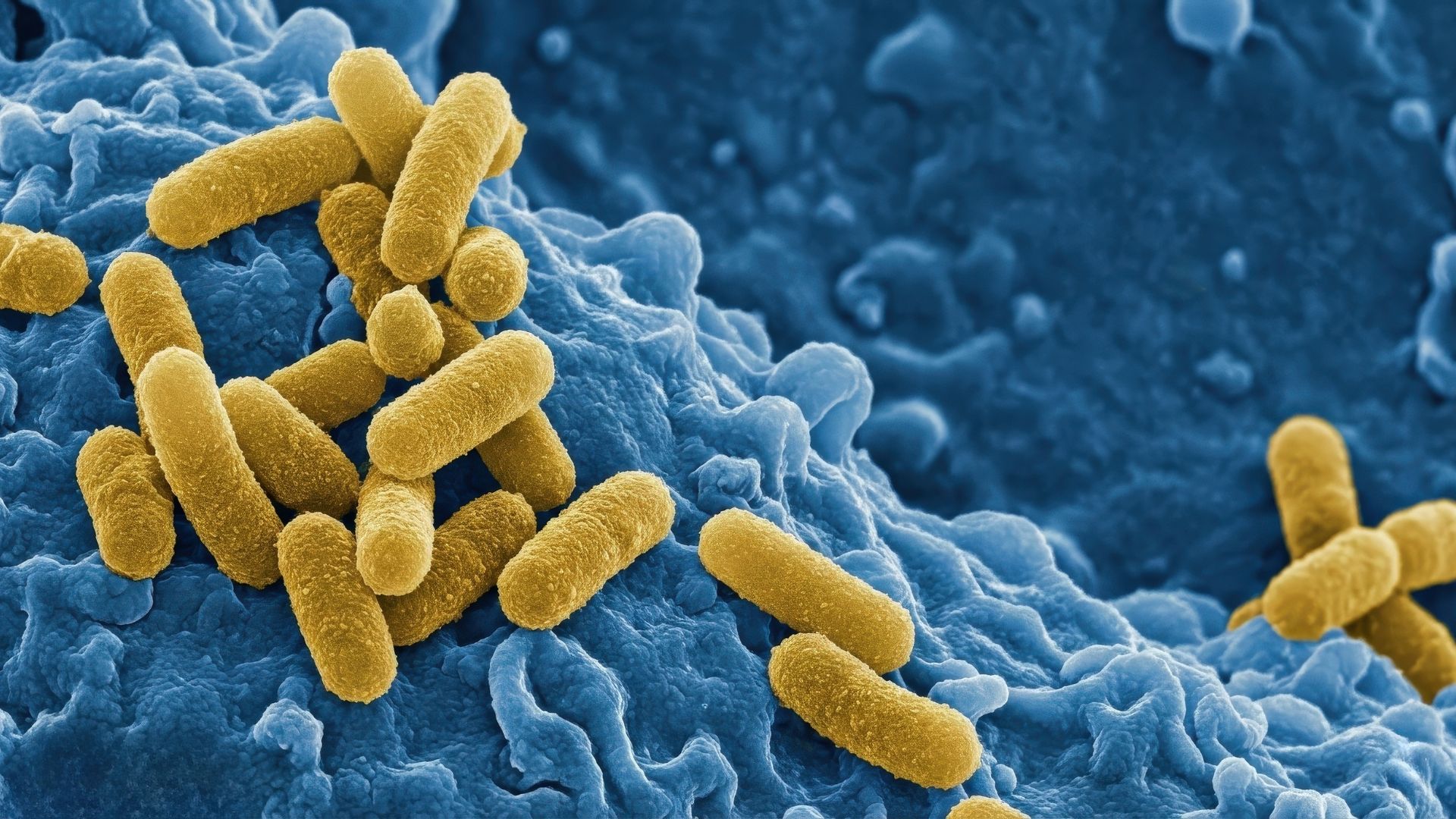 Nguyên nhân trực tiếp gây bệnh u hạt bẹn là nhiễm vi khuẩn&nbsp;Klebsiella granulomatis