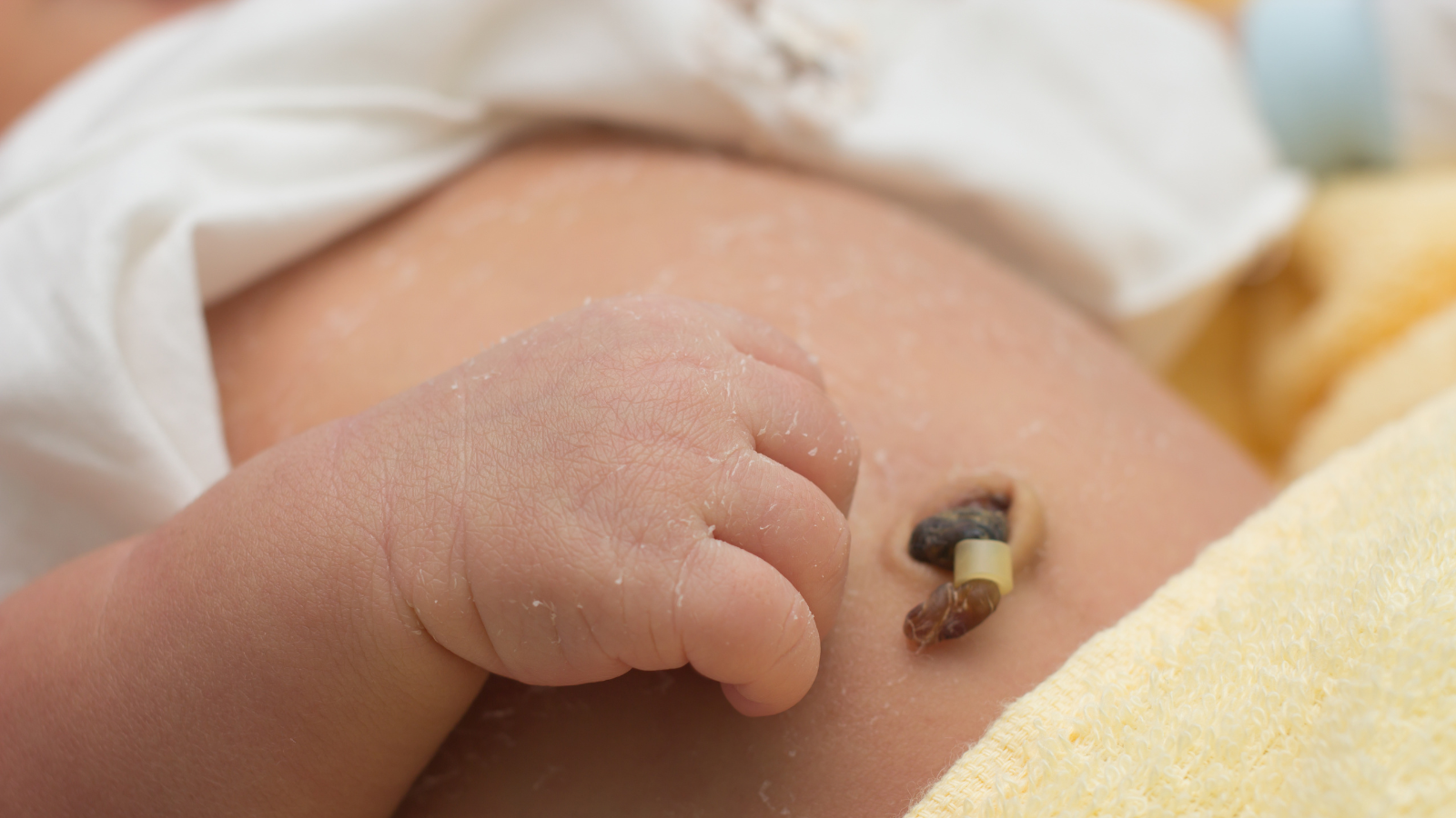 Giữ vùng rốn luôn khô ráo và sạch là cách đơn giản nhất để ngăn ngừa u hạt rốn ở trẻ sơ sinh