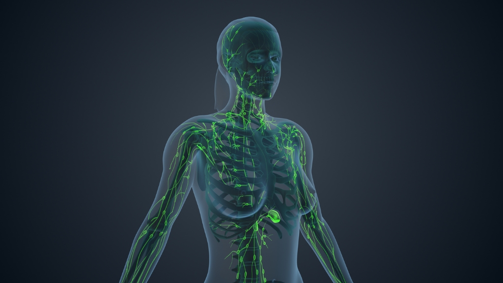 U lympho không Hodgkin là ung thư hạch ác tính của hệ lympho