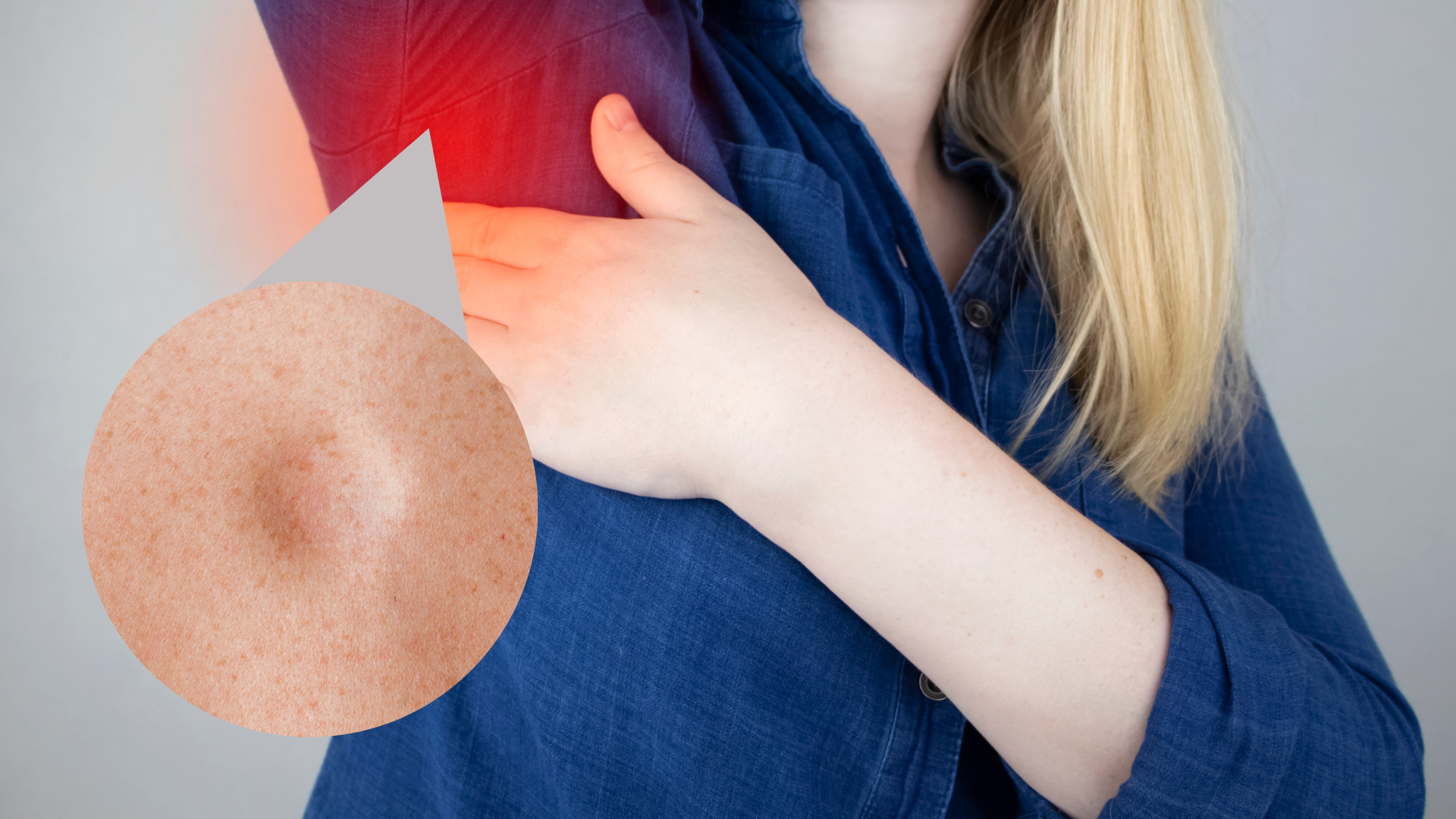 U mỡ ở nách thường mềm và không gây đau khi sờ nắn