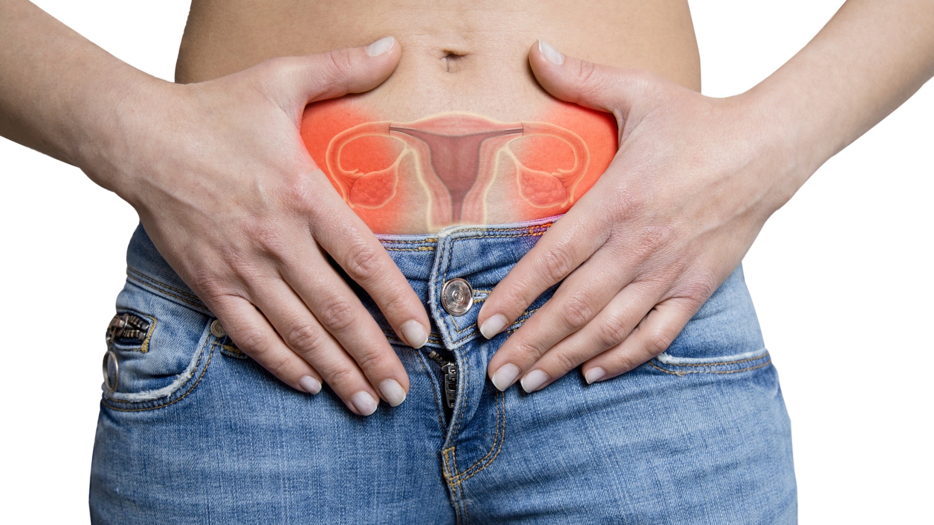 U nang buồng trứng xoắn có nguy hiểm không? Dấu hiệu của bệnh là gì? 1