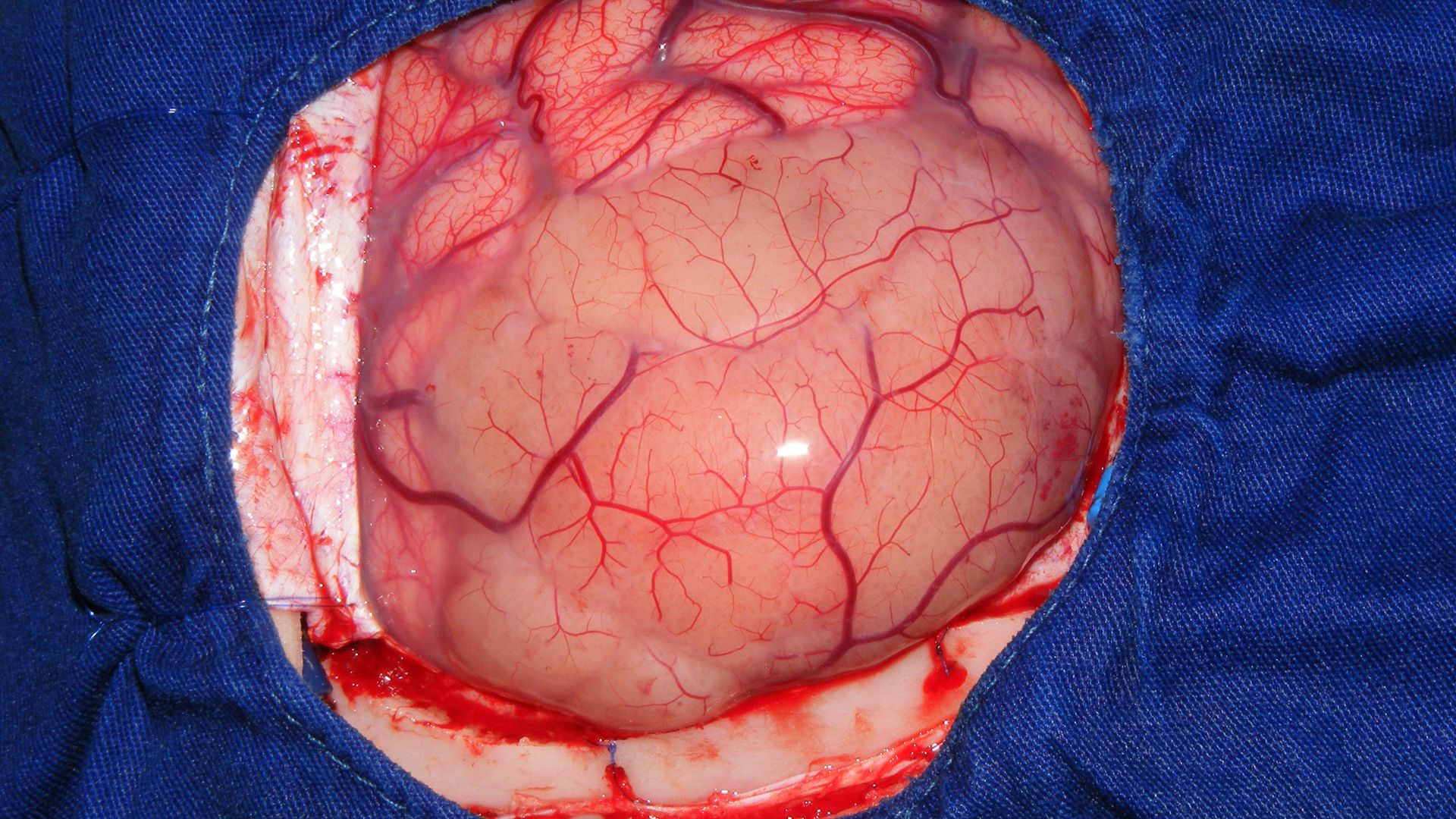 U não có di truyền không