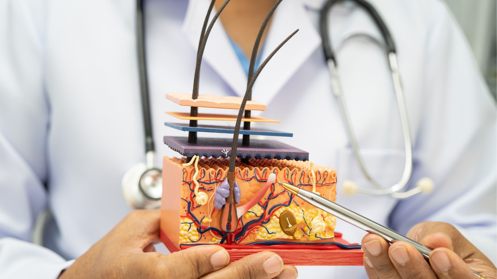 Minh họa vị trí hệ thống tiết mồ hôi nằm trong cấu trúc da