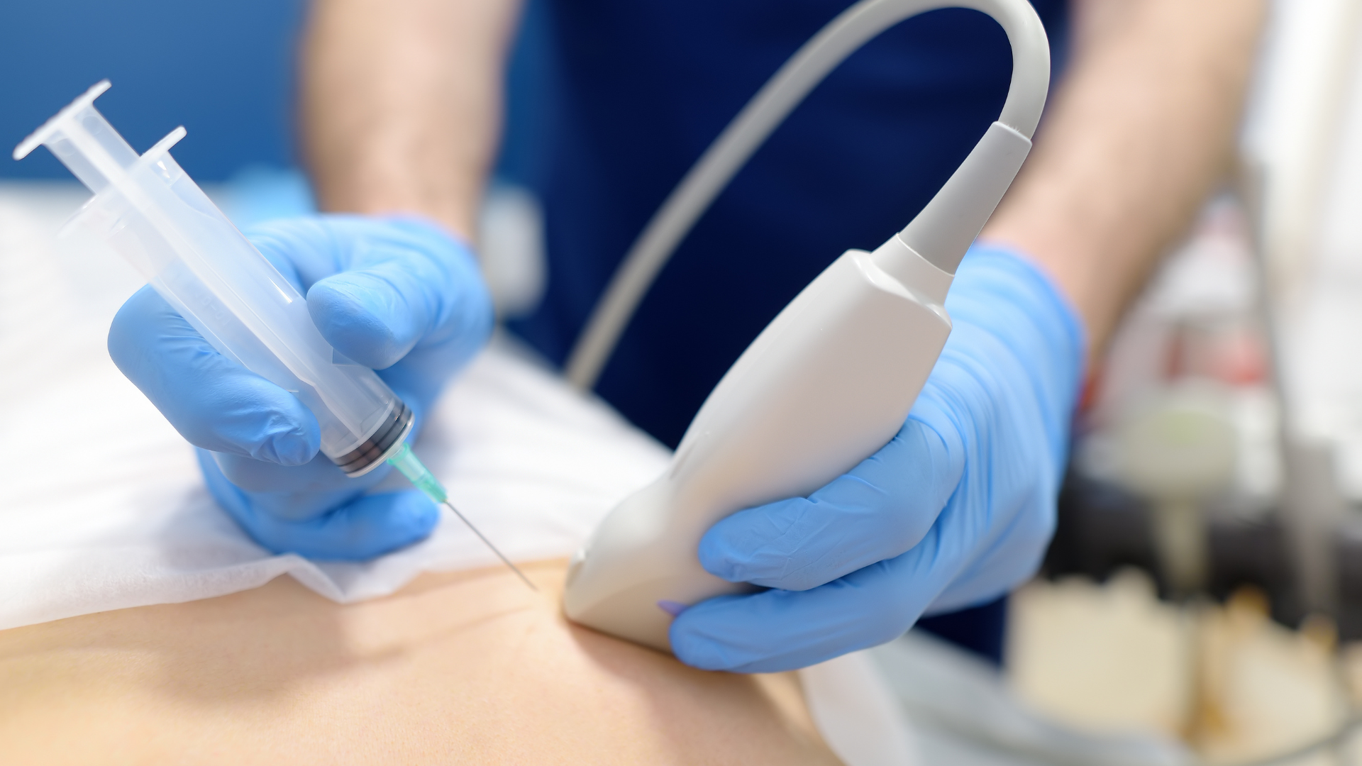 Sinh thiết mô vú là bước tiếp theo bắt buộc để xác định khối u lành hay ác