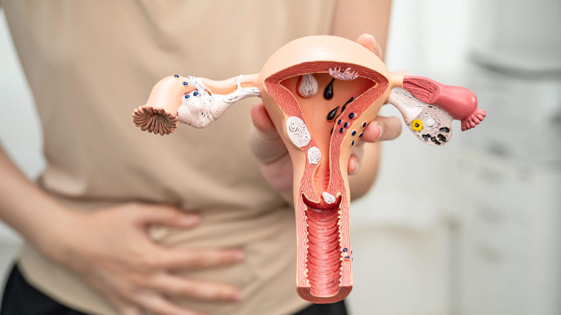 U xơ tử cung có được ăn lạc không? Những điều quan trọng cần biết 1