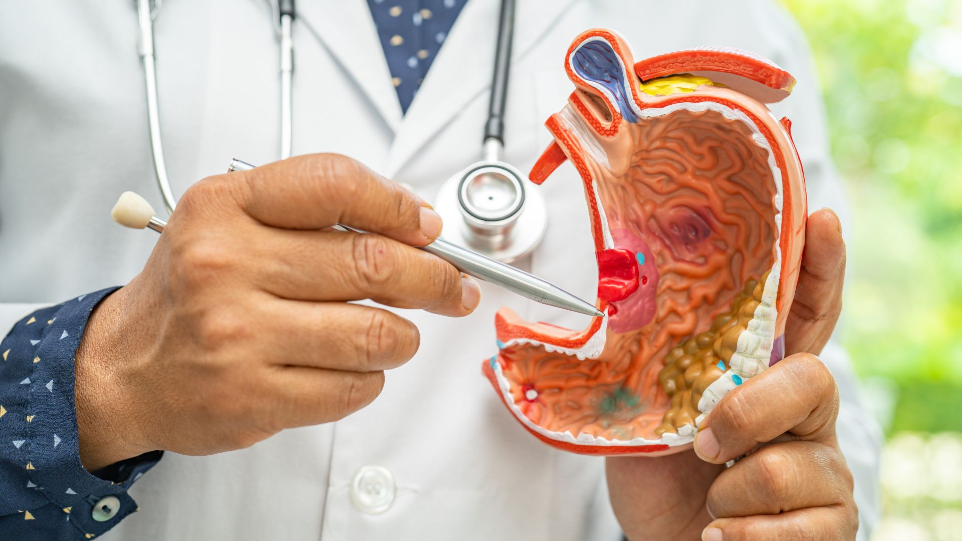 Ung thư dạ dày trẻ em: Nhận diện sớm và hướng điều trị an toàn 1