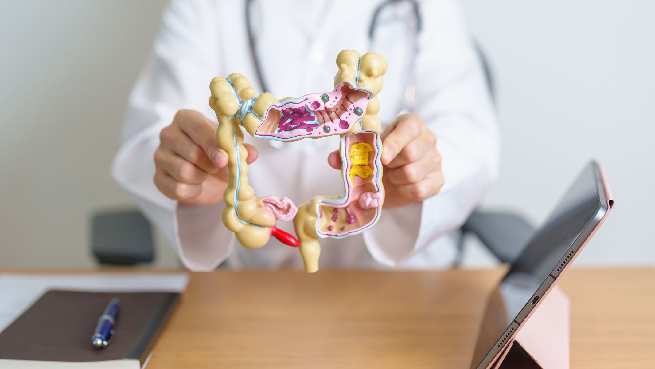 Ung thư đại tràng di căn xương là tình trạng tế bào ung thư xuất phát từ đại tràng lan sang mô xương