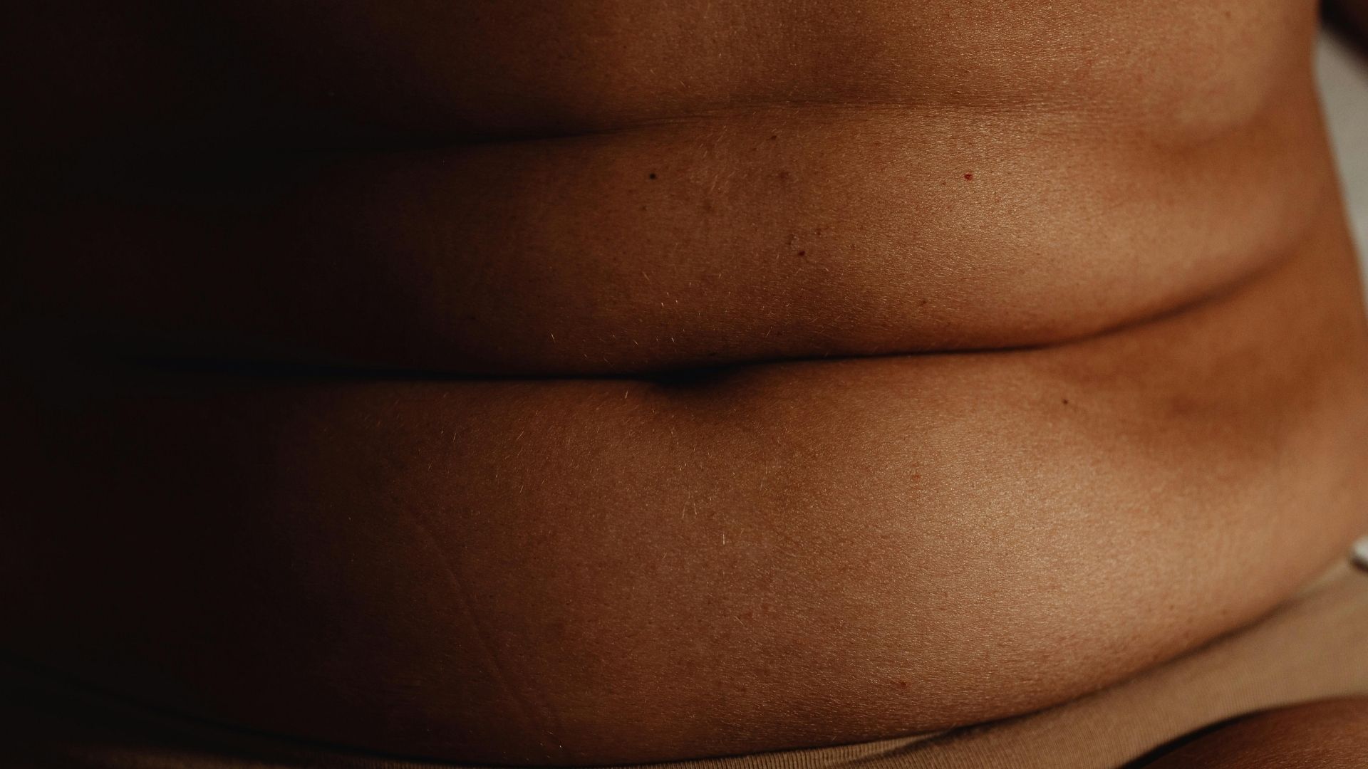 Béo phì làm tăng nguy cơ mắc ung thư đường mật