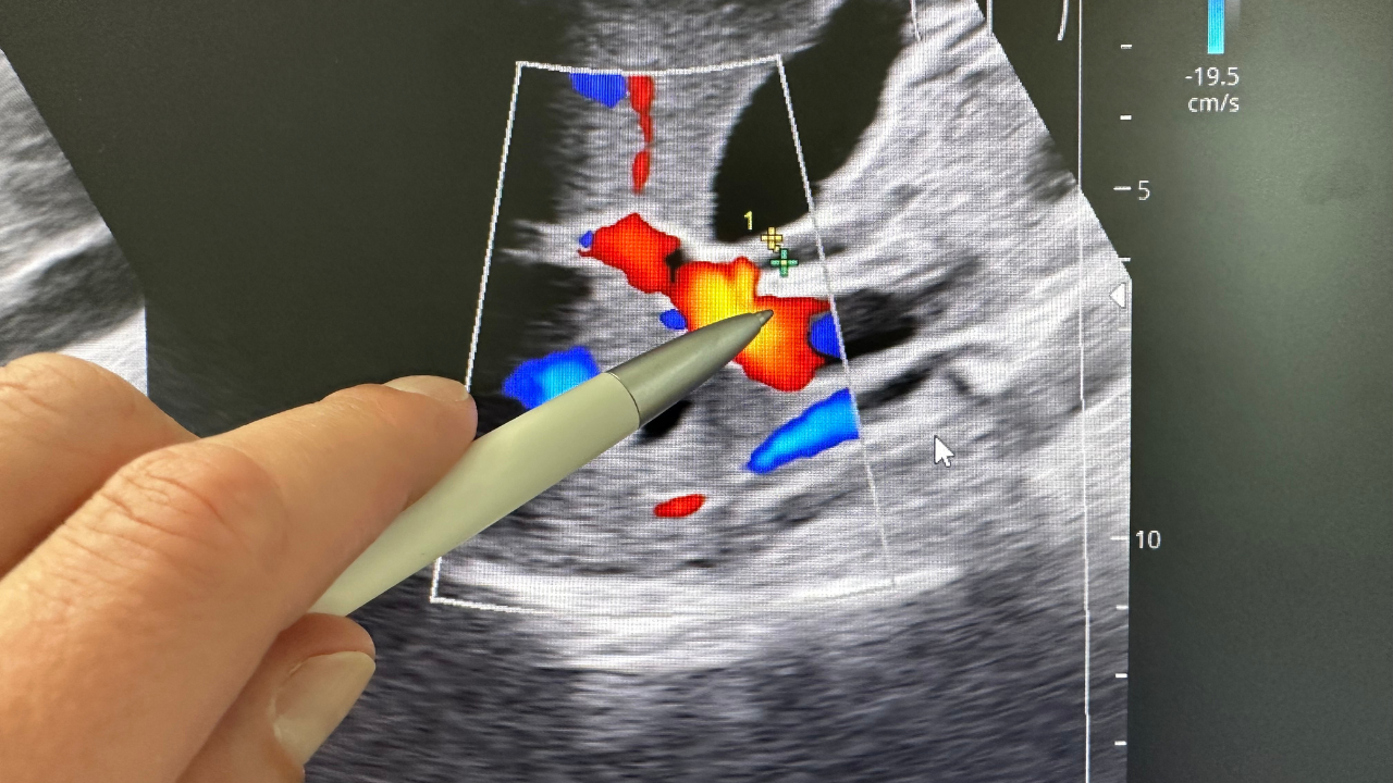 Khám sức khỏe định kỳ và theo dõi tình trạng sức khỏe của người bệnh