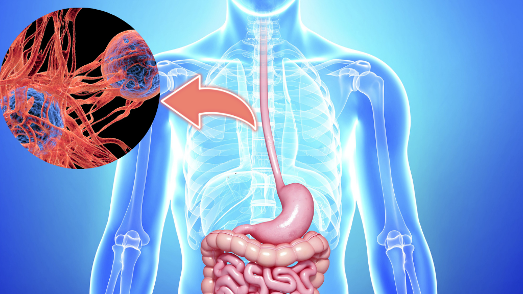 Ung thư thực quản là bệnh lý ác tính xuất phát từ các tế bào trong thành thực quản