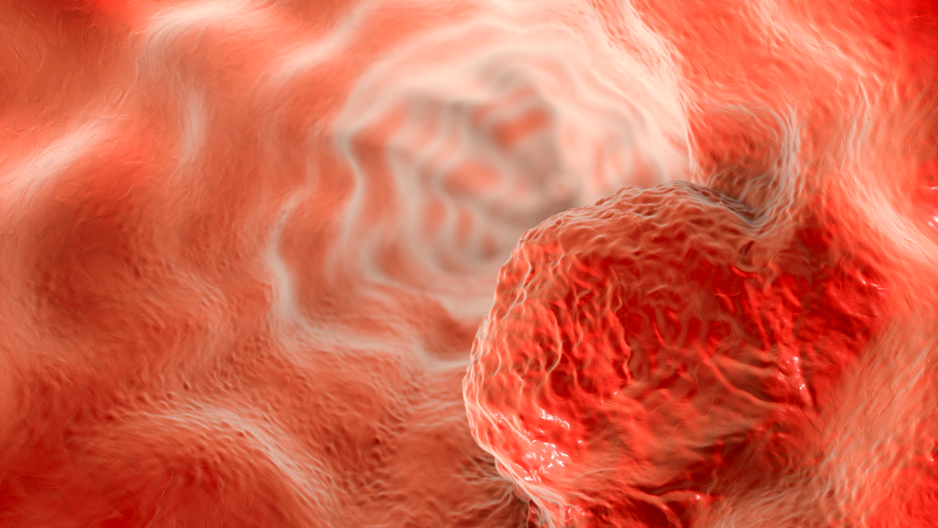 Ung thư thực quản là gì?