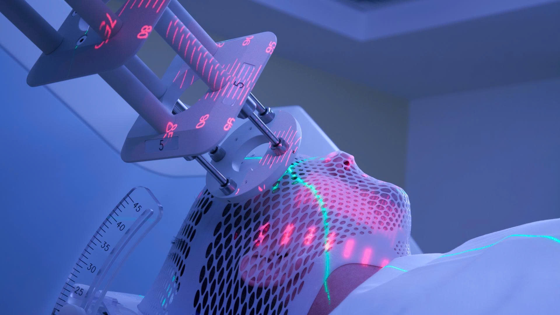 Ung thư được điều trị bằng nhiều phương pháp khác nhau tùy theo giai đoạn và thể trạng người bệnh