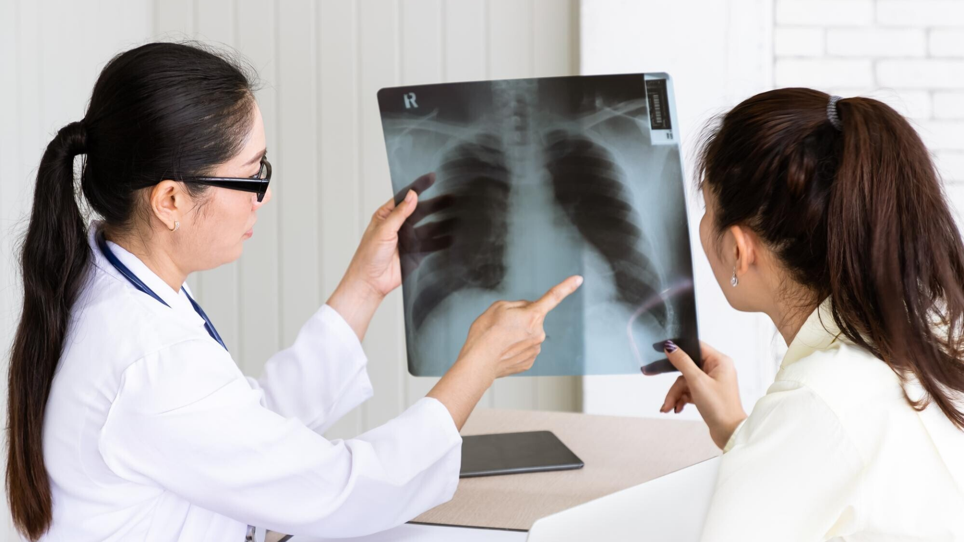 Ung thư tuyến giáp thể nang có xu hướng di căn xa tới phổi hoặc xương cao hơn