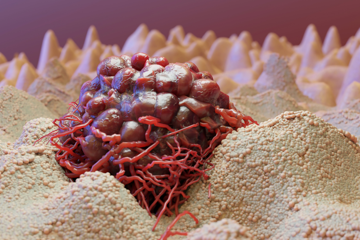 ung-thu-vom-hong-8-dau-hieu-va-cach-phong-ngua-benh 3.png