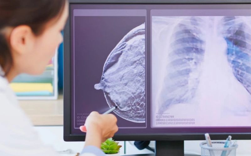 Nên khám vú định kỳ để phát hiện sớm các bất thường và điều trị kịp thời