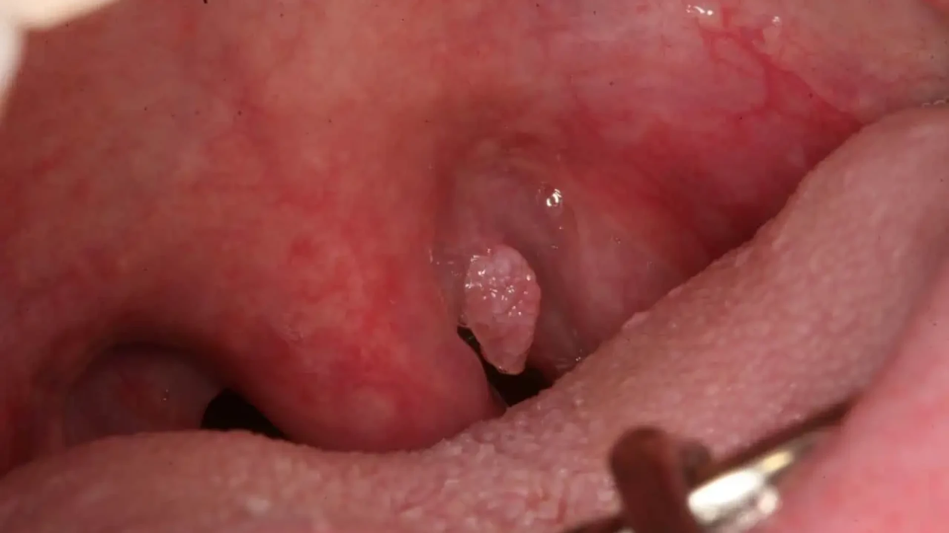 1_df24015c1d