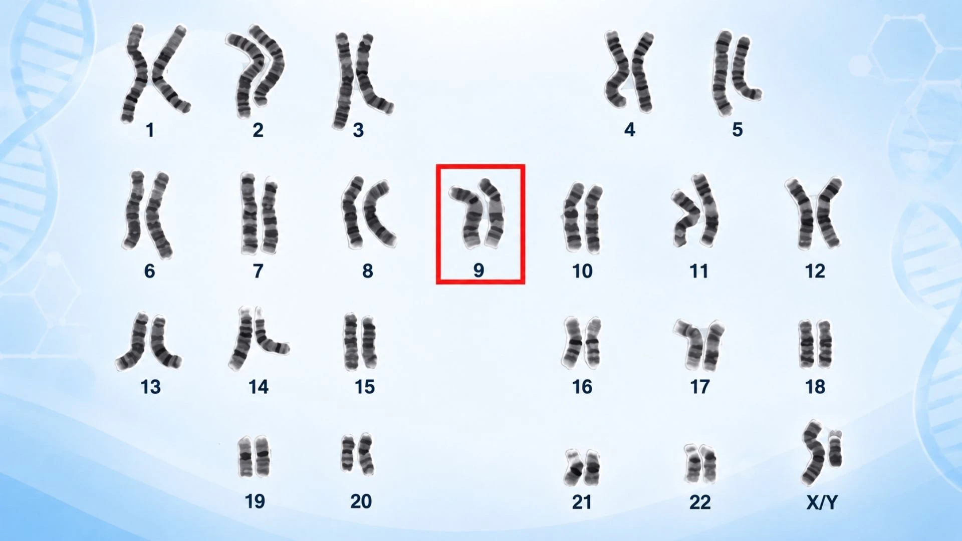 Bất thường nhiễm sắc thể số 9 là gì? Các dạng và ảnh hưởng thường gặp