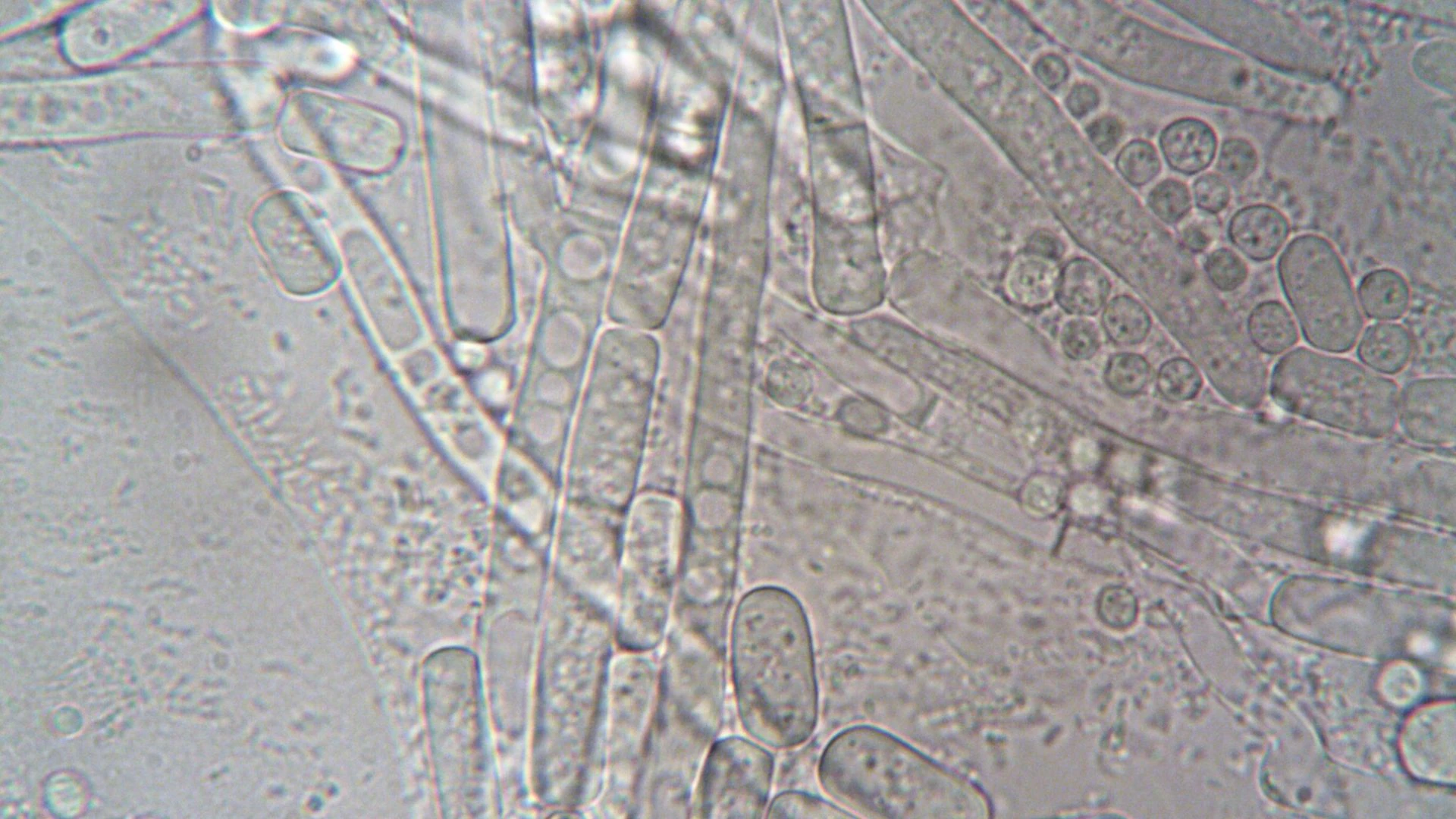 benh_a_z_benh_cyclosporiasis1_bcf7c0e25c