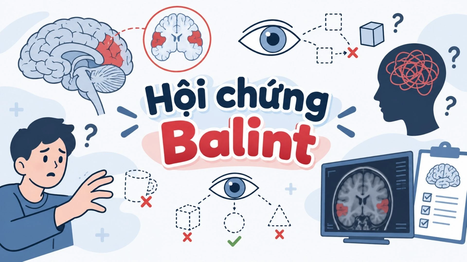 benh_a_z_hoi_chung_balint_1_debb374a55