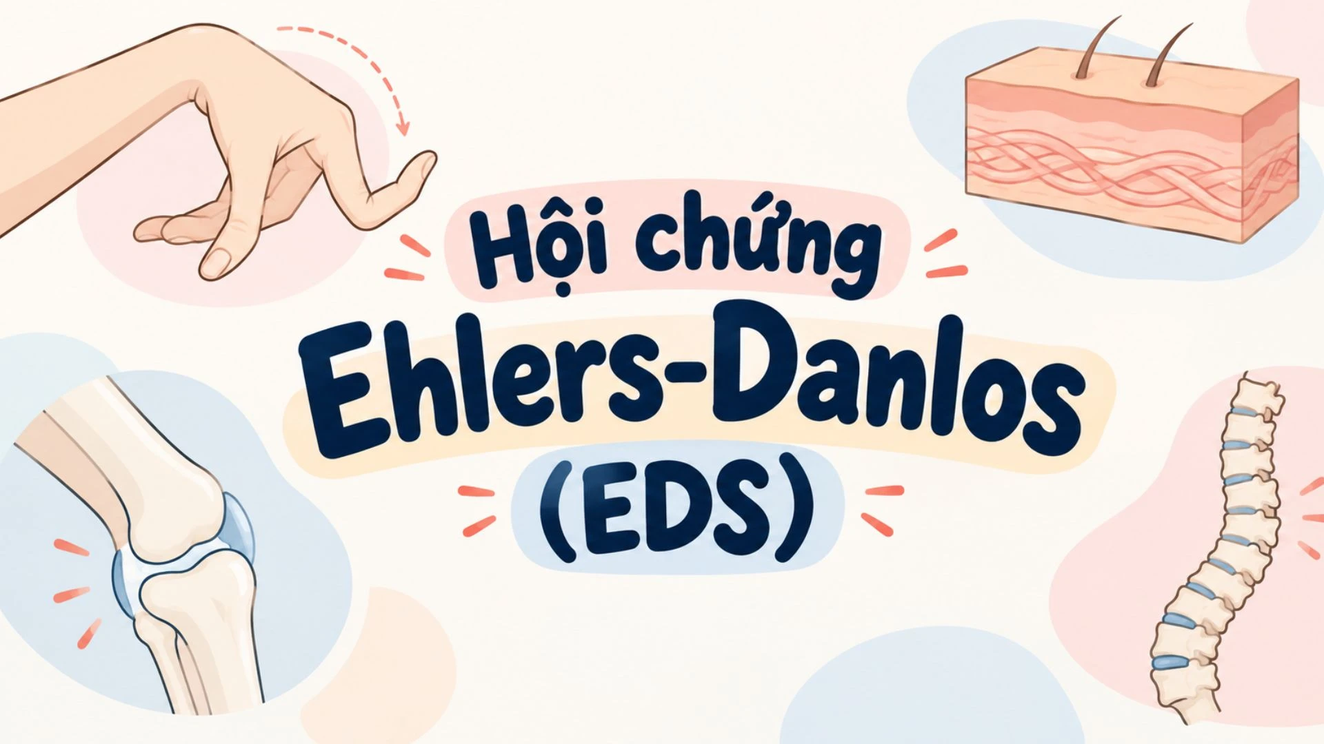 benh_a_z_hoi_chung_ehlers_danlos_1_06274d8c84
