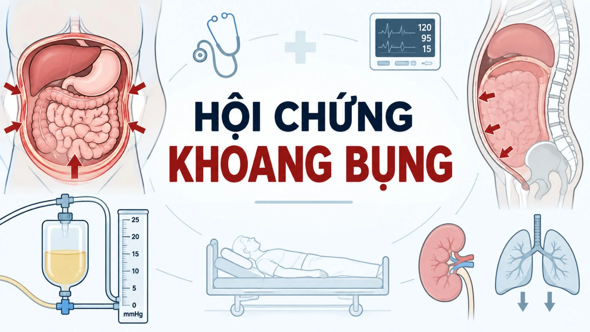 benh_a_z_hoi_chung_khoang_bung_1_c45517c1f8