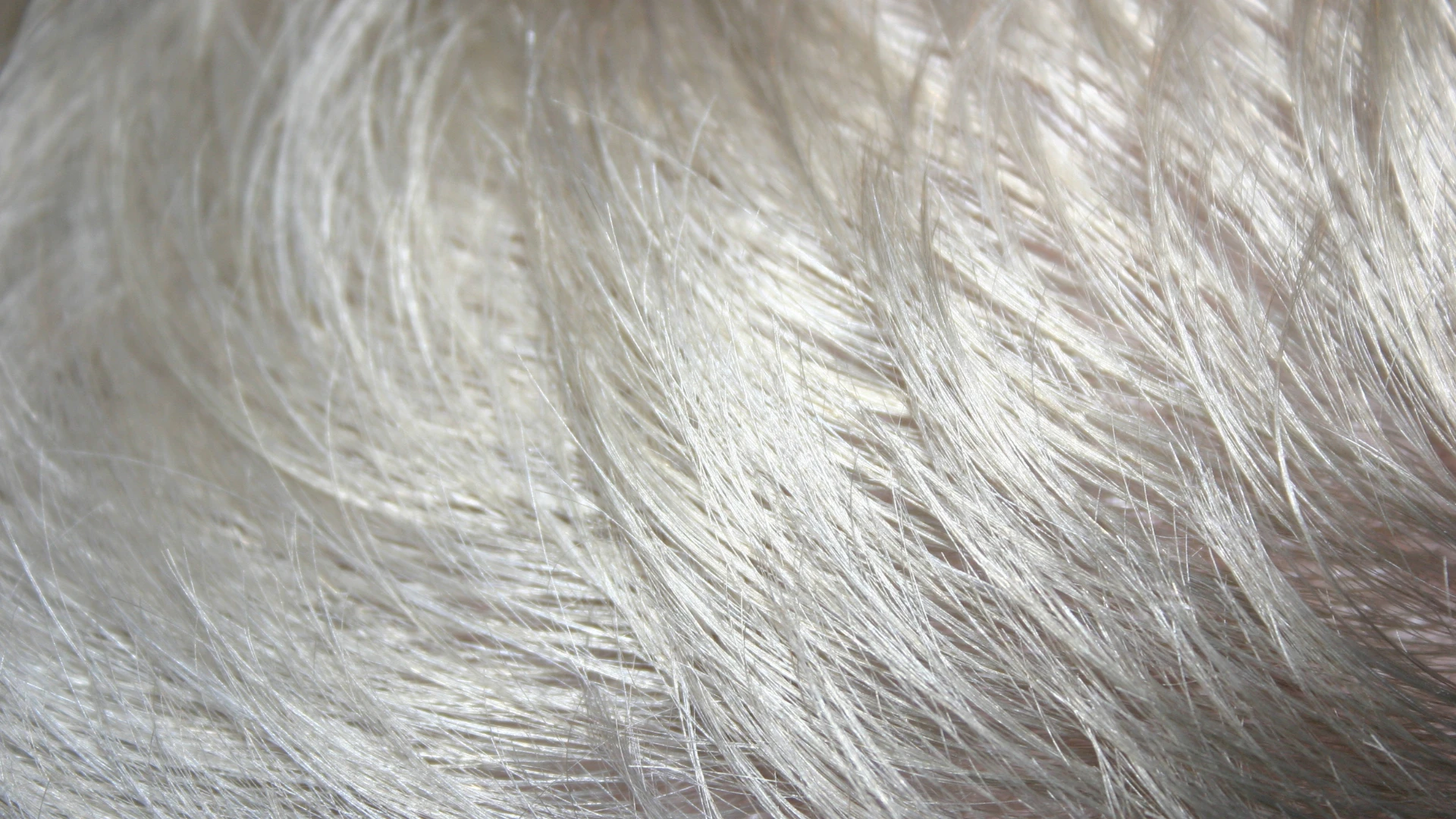 benh_a_z_hoi_chung_marie_antoinette_1_e856de59f8